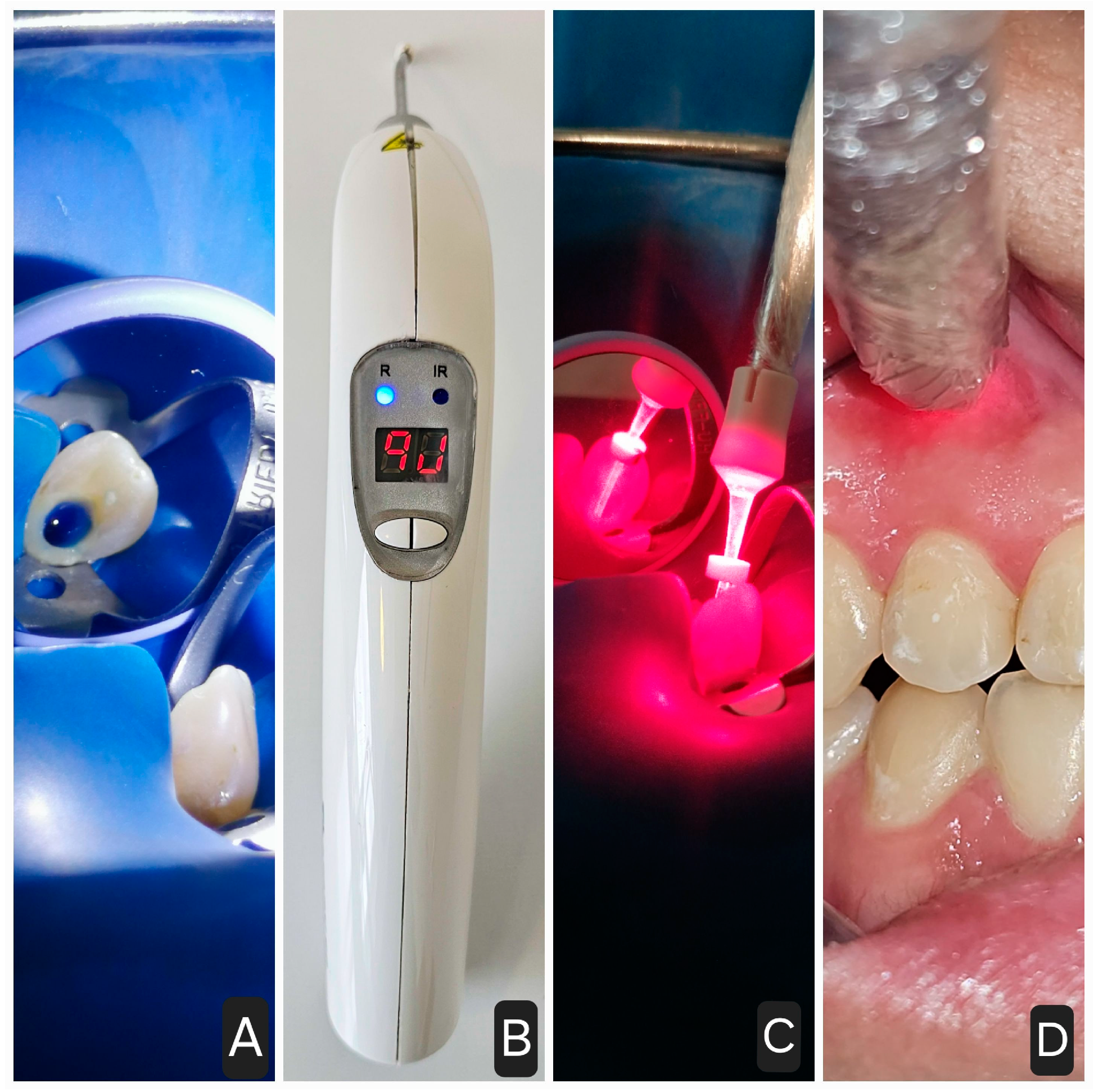 Applsci 14 09341 g004