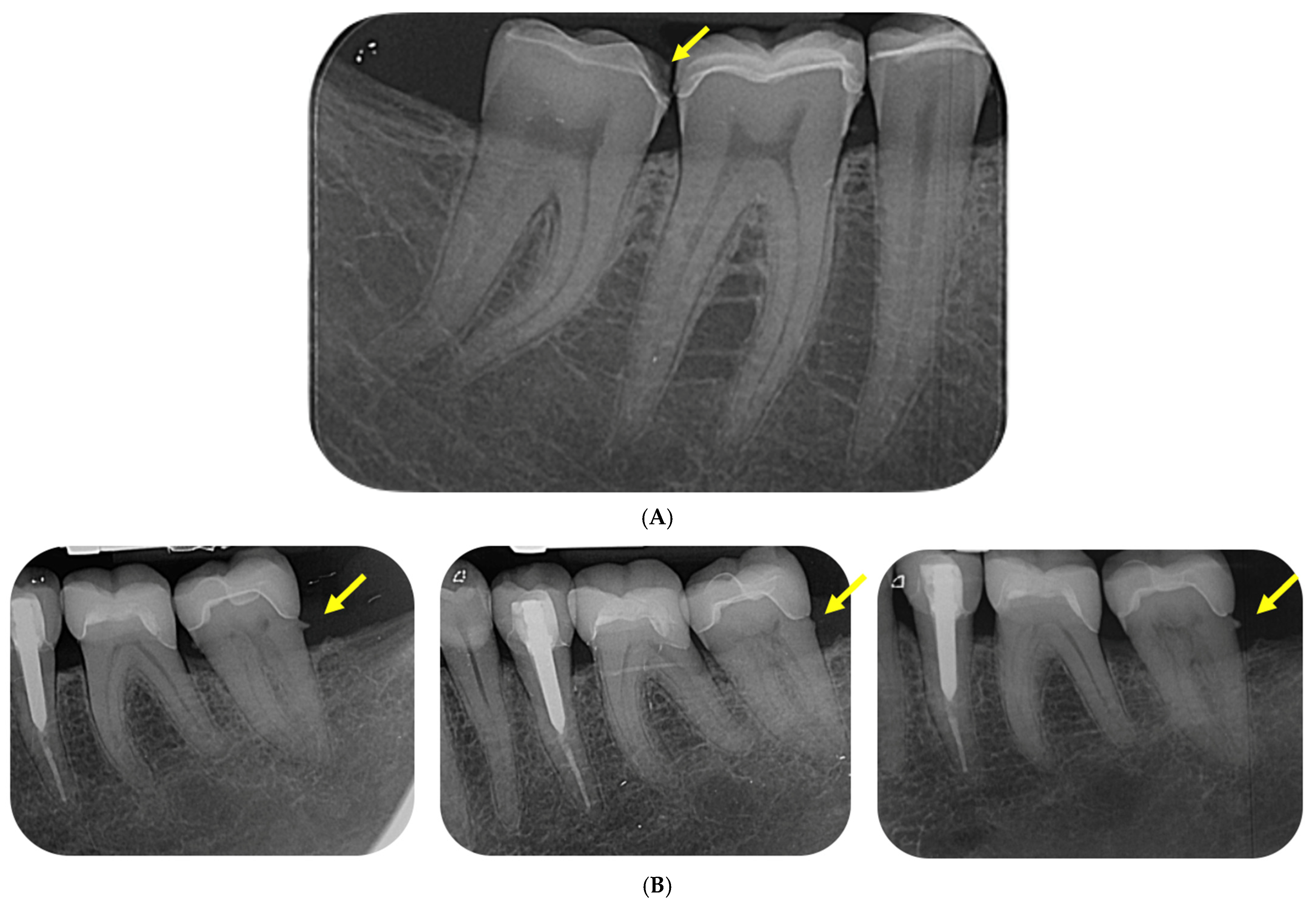 Biomimetic Capabilities of Lithium Disilicate Glass-Ceramic