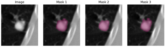 Evaluating Uncertainty Quantification in Medical Image Segmentation: A ...