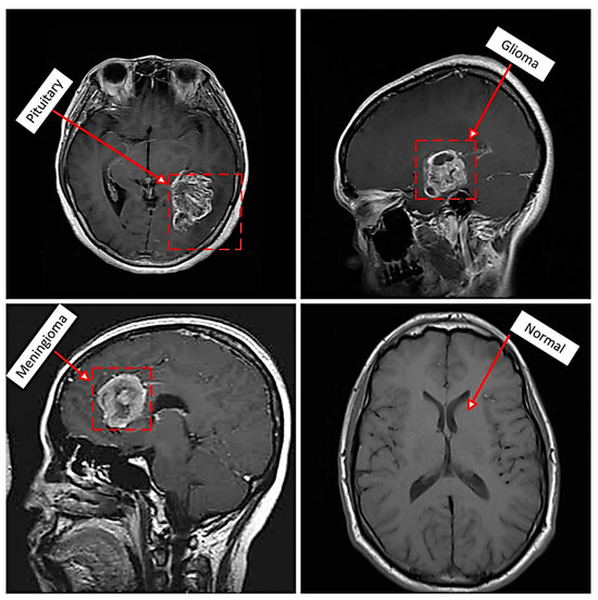 【美品・電子版使用済】Diagnostic Imaging: Brain 脳画像 美品・電子版使用済】Diagnostic Imaging: Brain 脳画像 美品