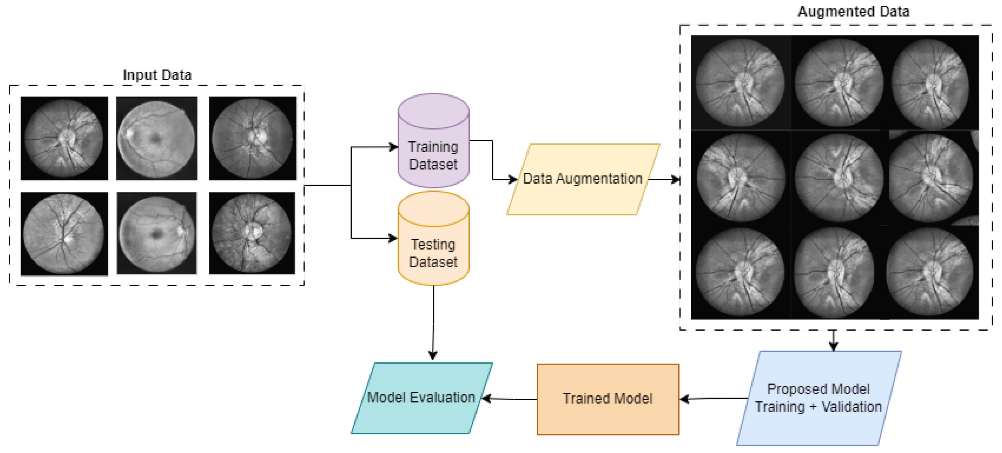 Transformer-Enhanced Retinal Vessel Segmentation for Diabetic ...