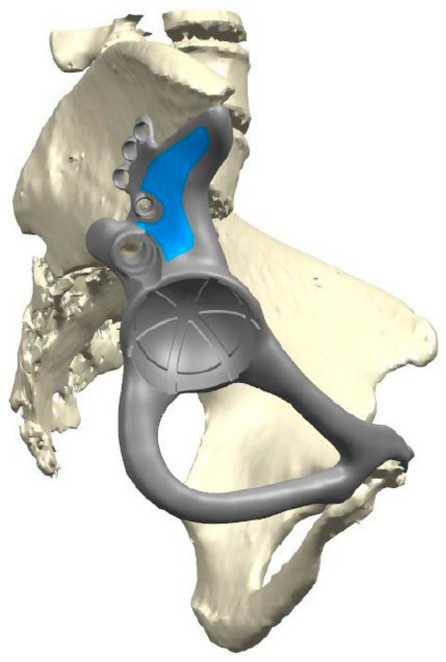 Applsci 14 11054 g003