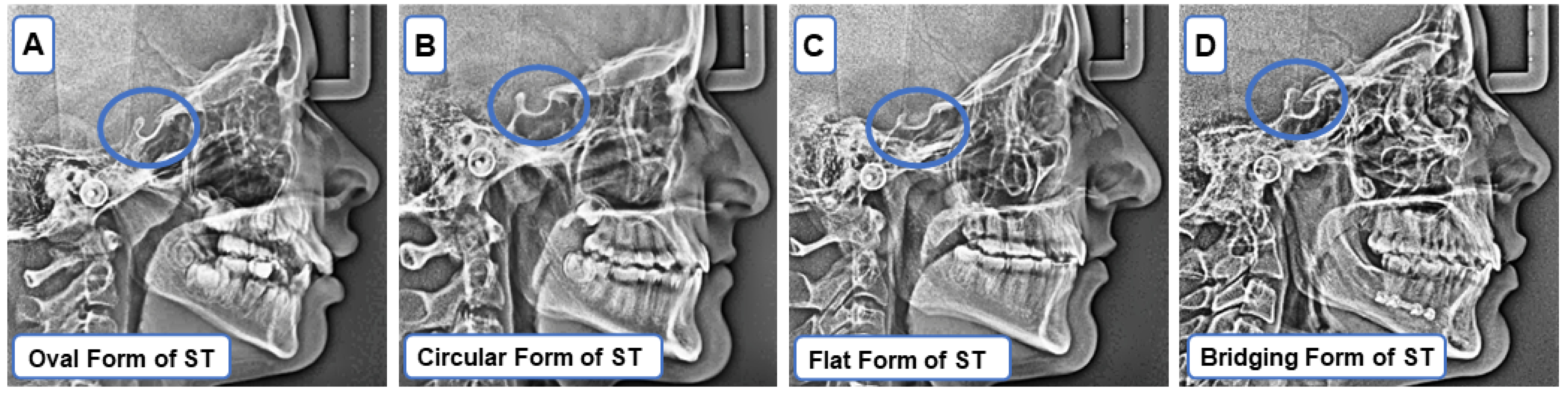 Applsci 14 11154 g001