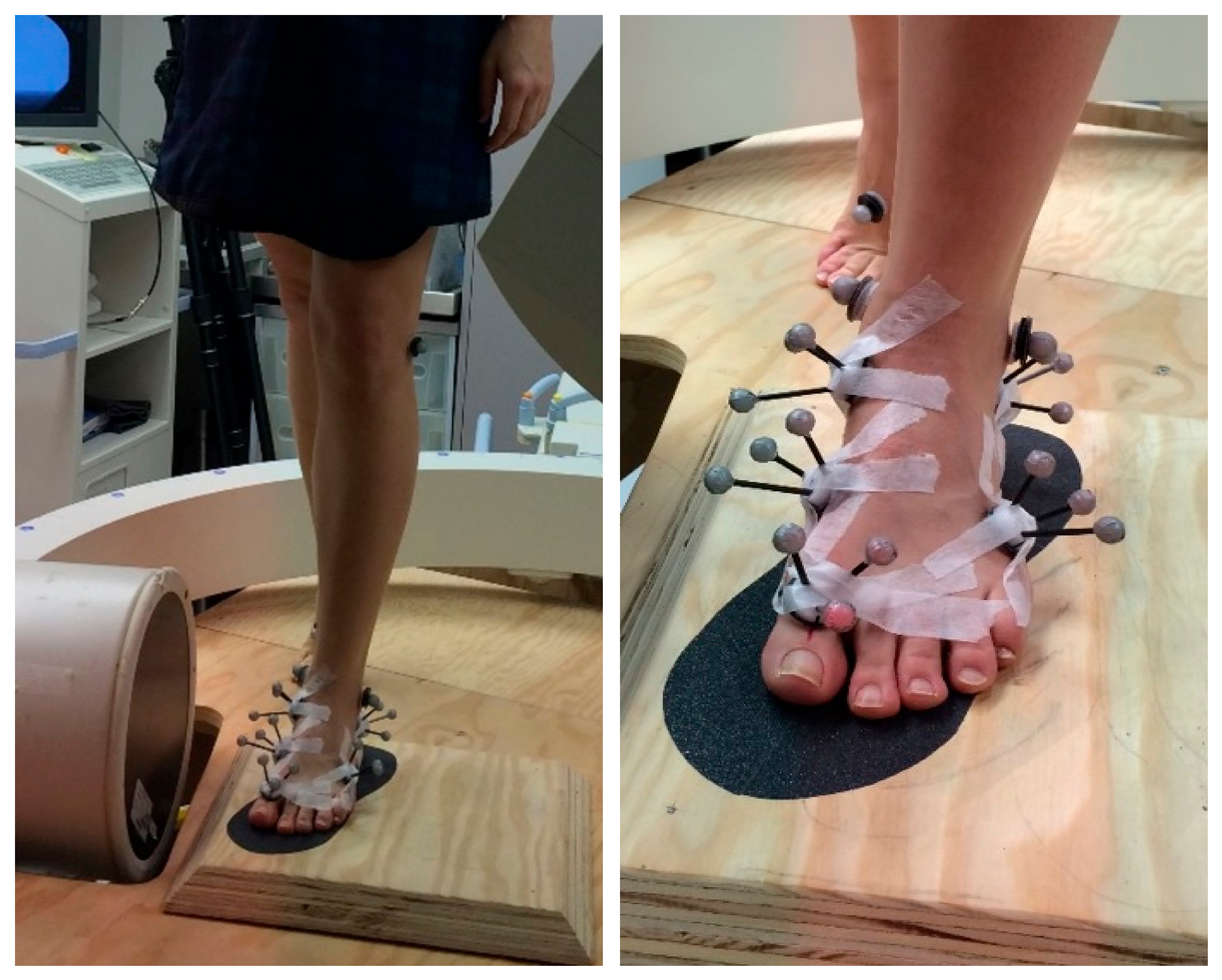 Applsci 14 11285 g001