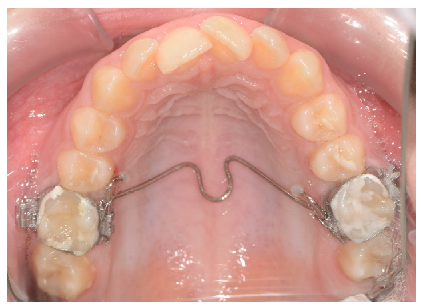 Applsci 14 11333 g002 Applsci 14 11333 g002