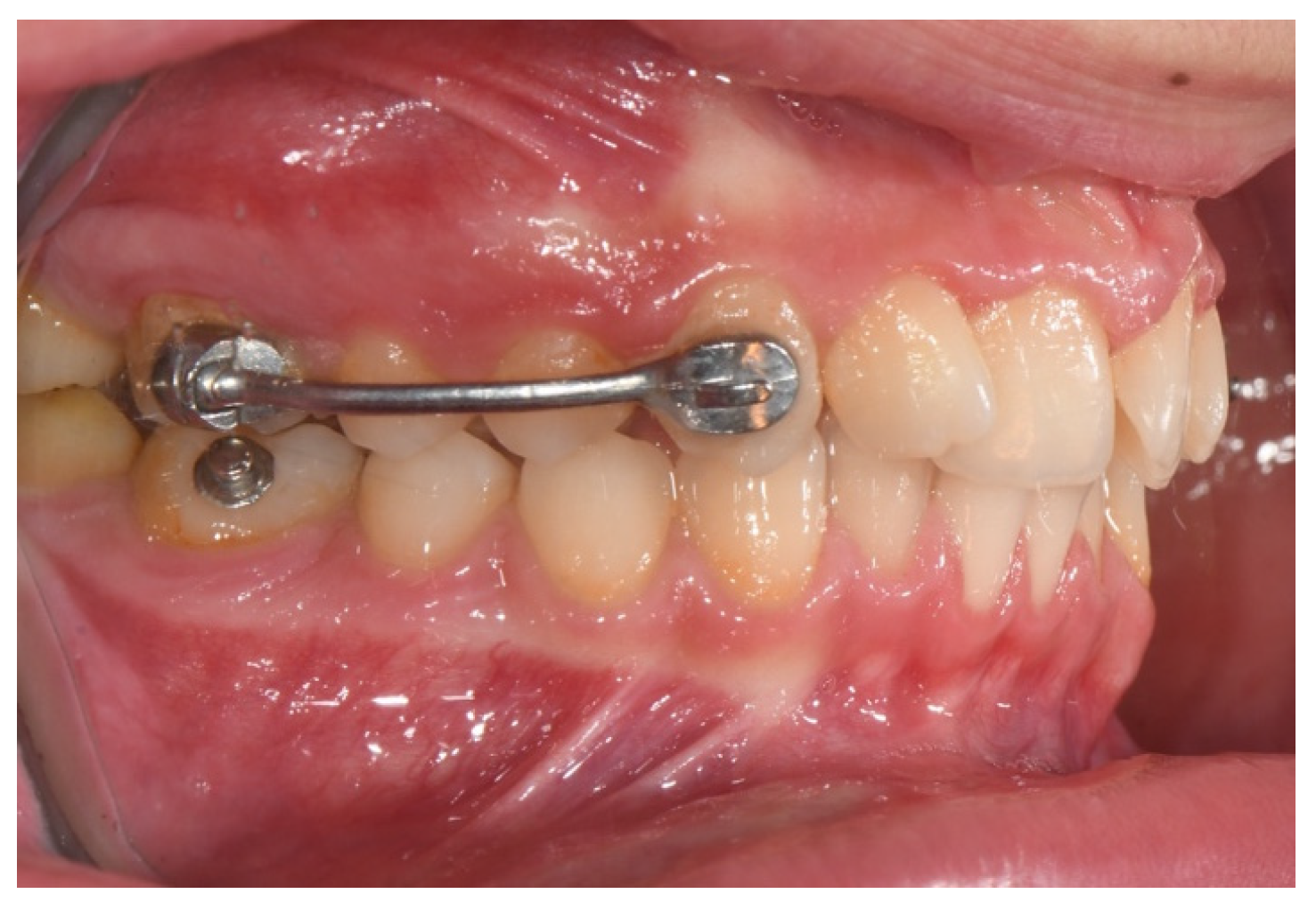 Applsci 14 11333 g005 Applsci 14 11333 g005