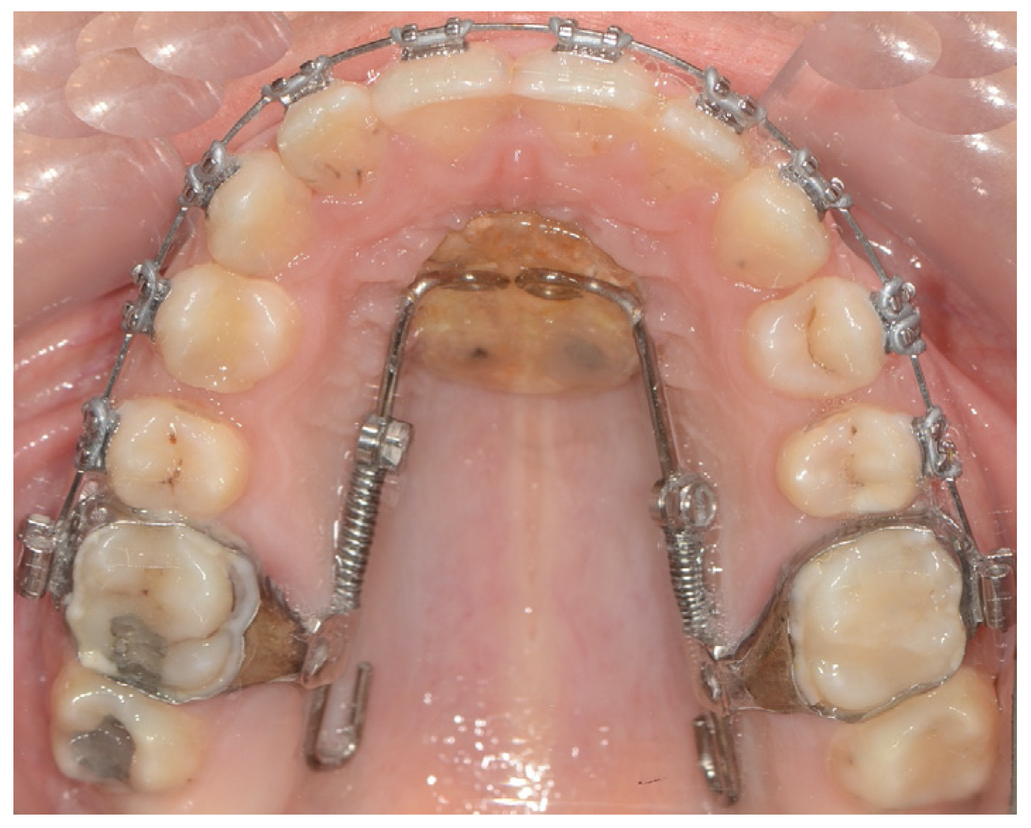 Applsci 14 11333 g009 Applsci 14 11333 g009