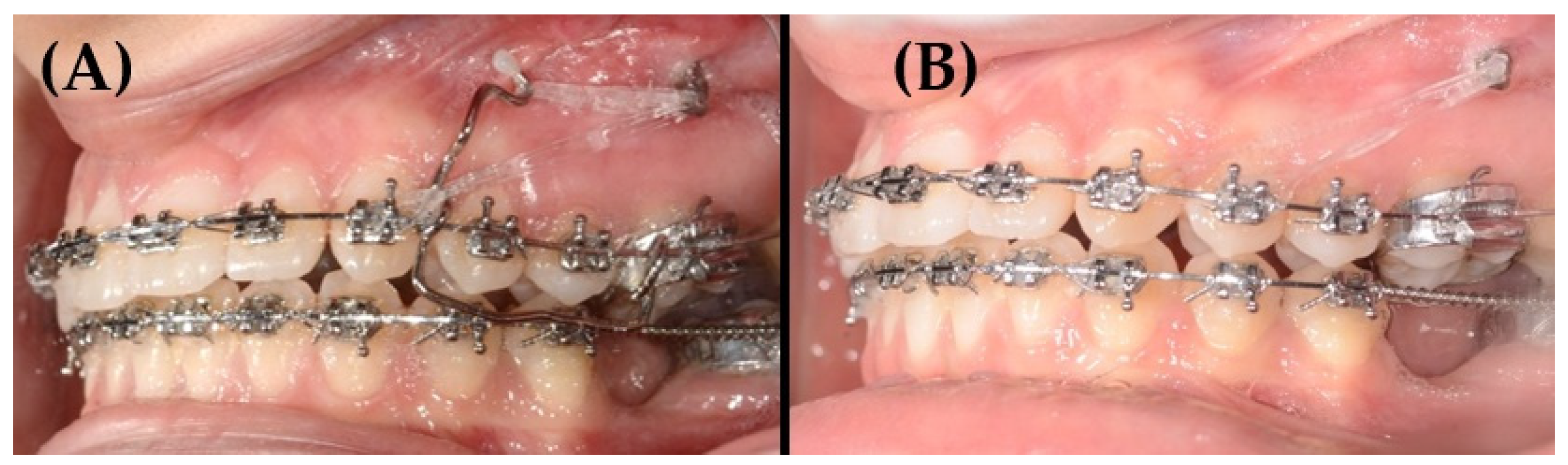 Applsci 14 11333 g011 Applsci 14 11333 g011