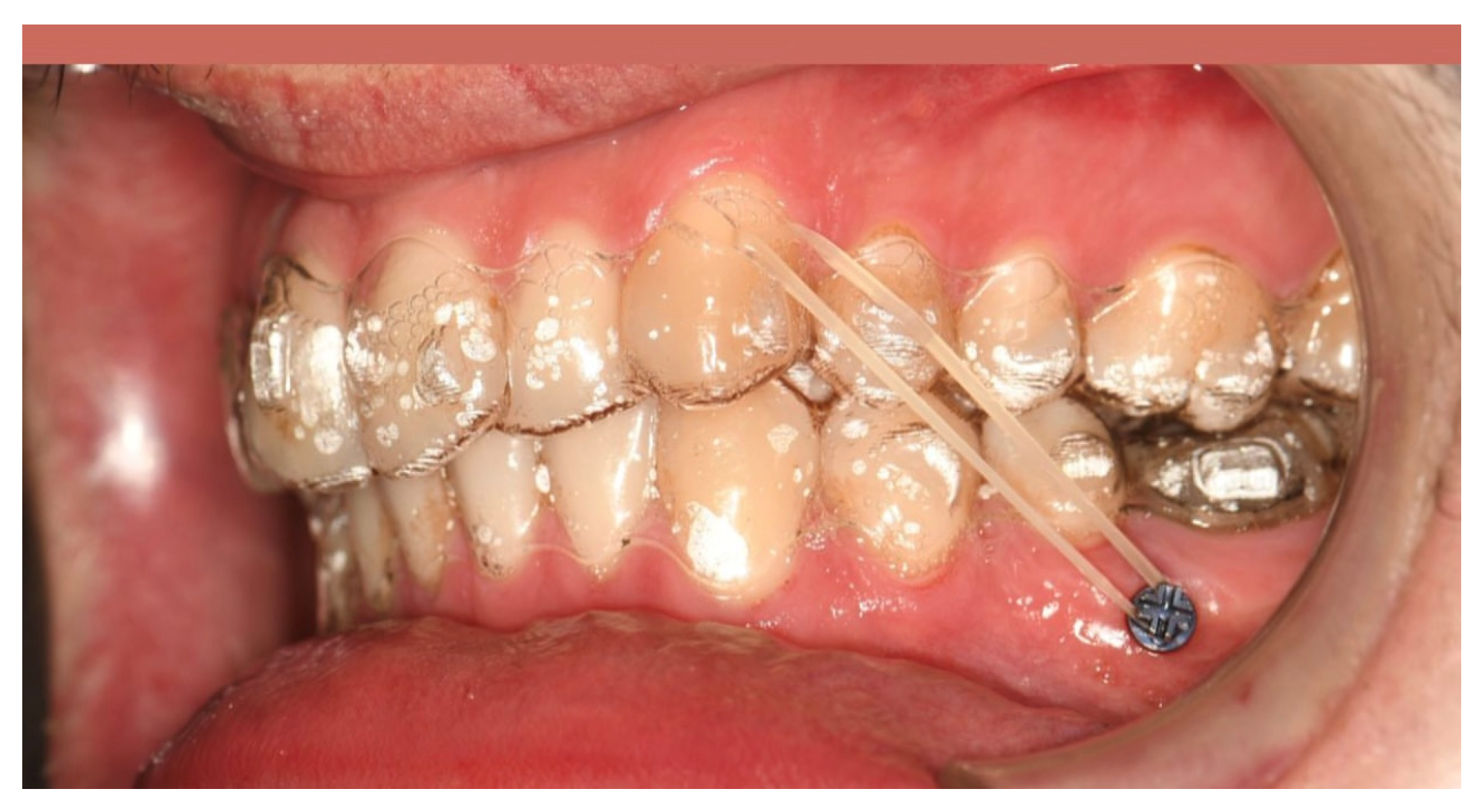 Applsci 14 11333 g012 Applsci 14 11333 g012