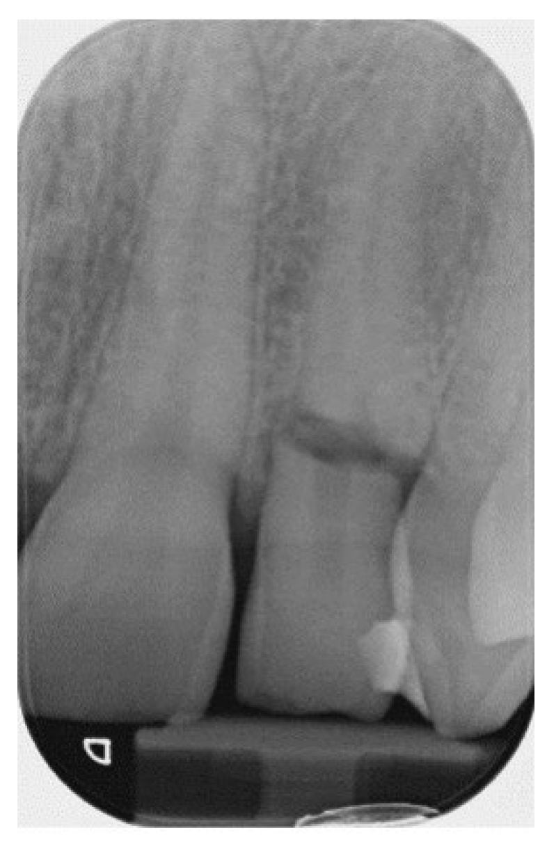 Applsci 14 11370 g002