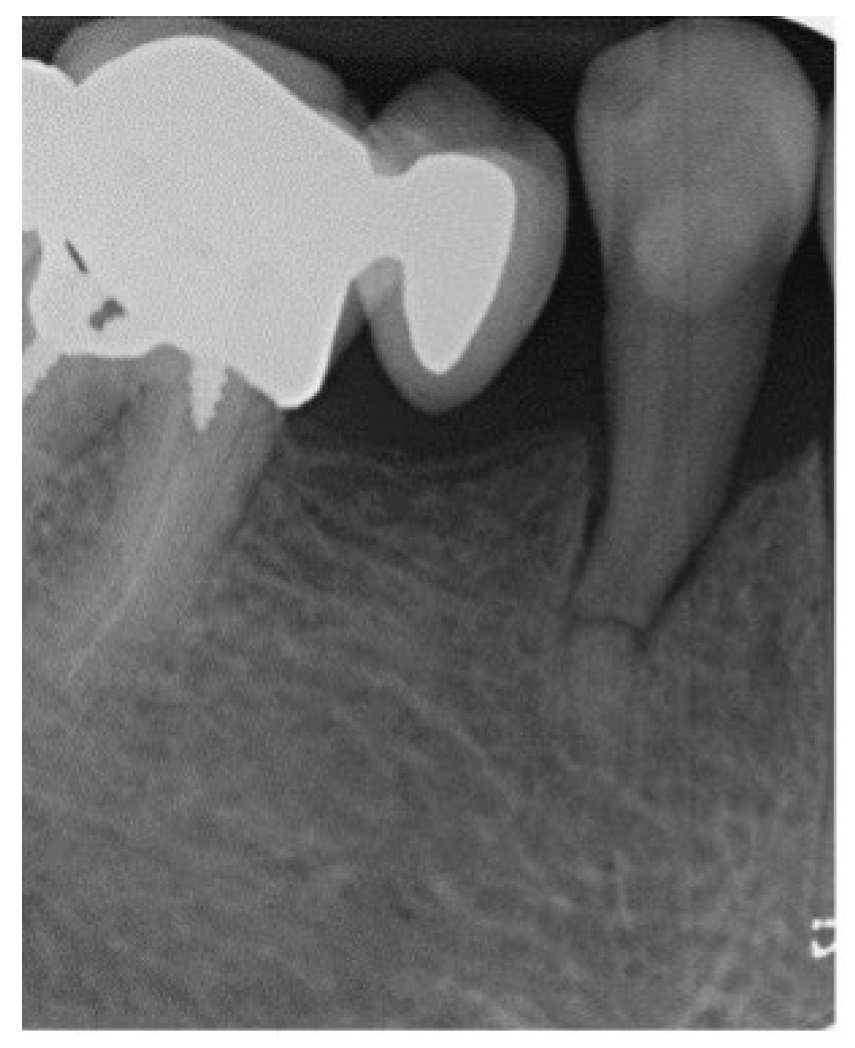 Applsci 14 11370 g004