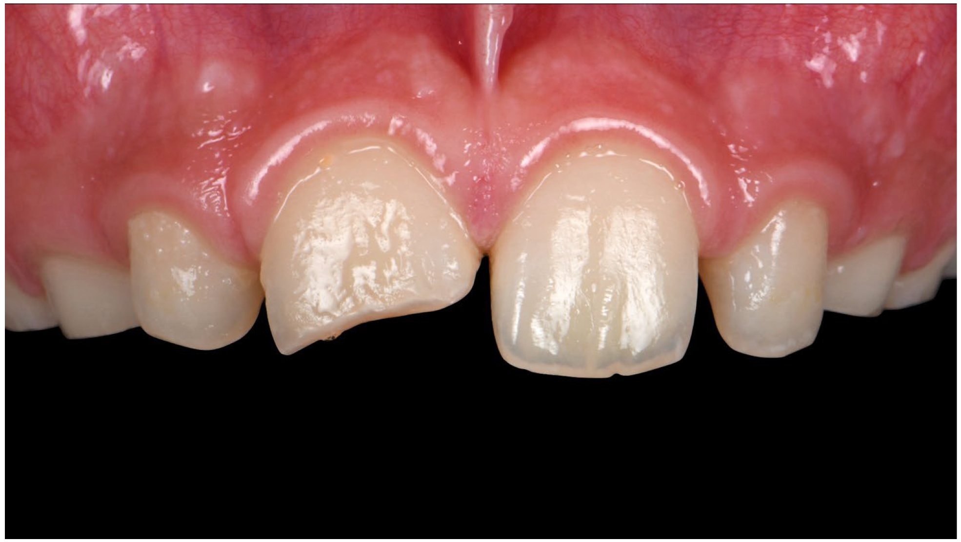 Applsci 14 11370 g005