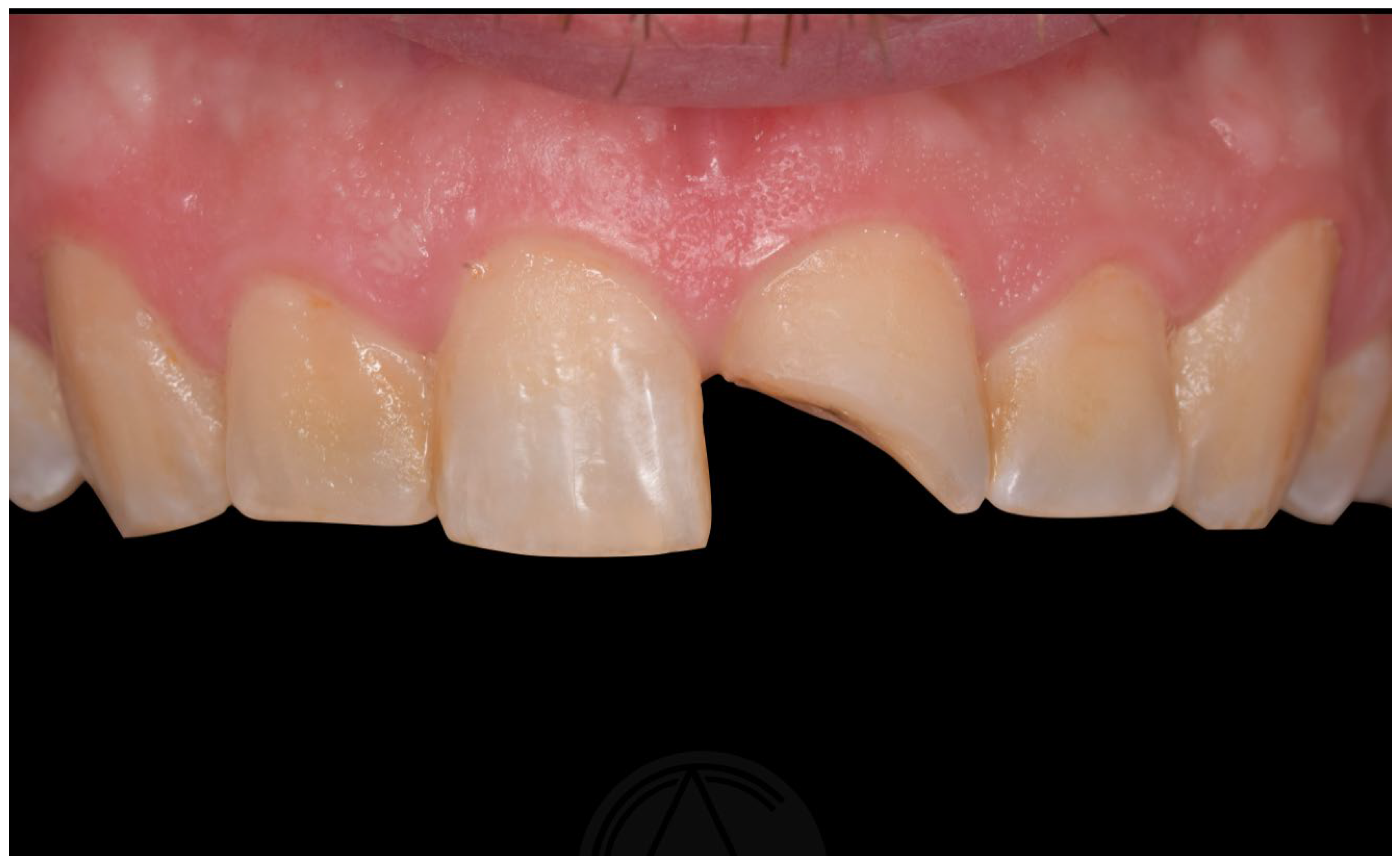 Applsci 14 11370 g006