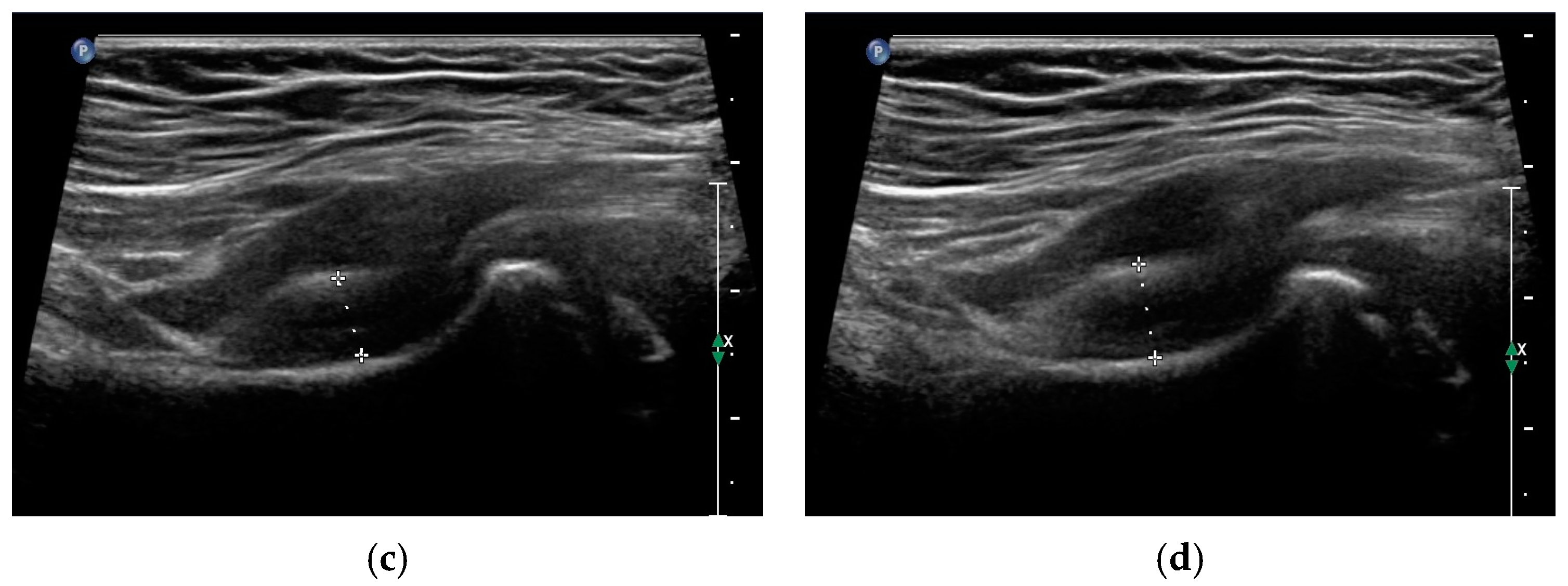 Applsci 14 11795 g004b Applsci 14 11795 g004b