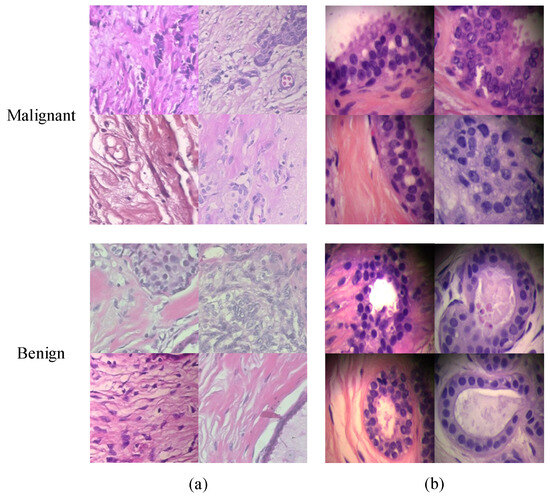 Breast Histopathological Image Classification Based on Auto-Encoder ...