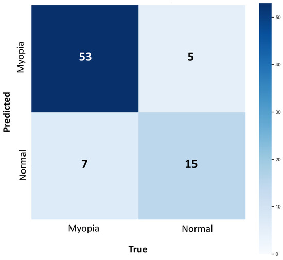Myopia Detection from Eye Fundus Images: New Screening Method Based on ...