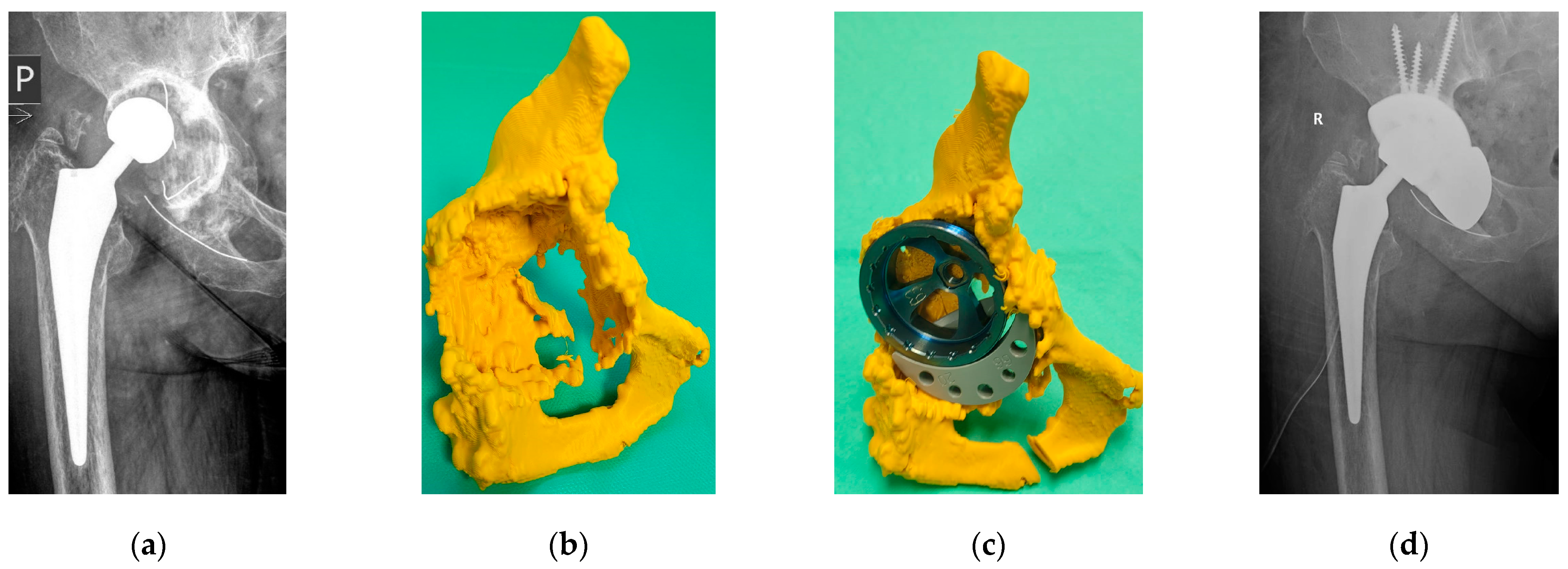 Applsci 15 00134 g025 Applsci 15 00134 g025