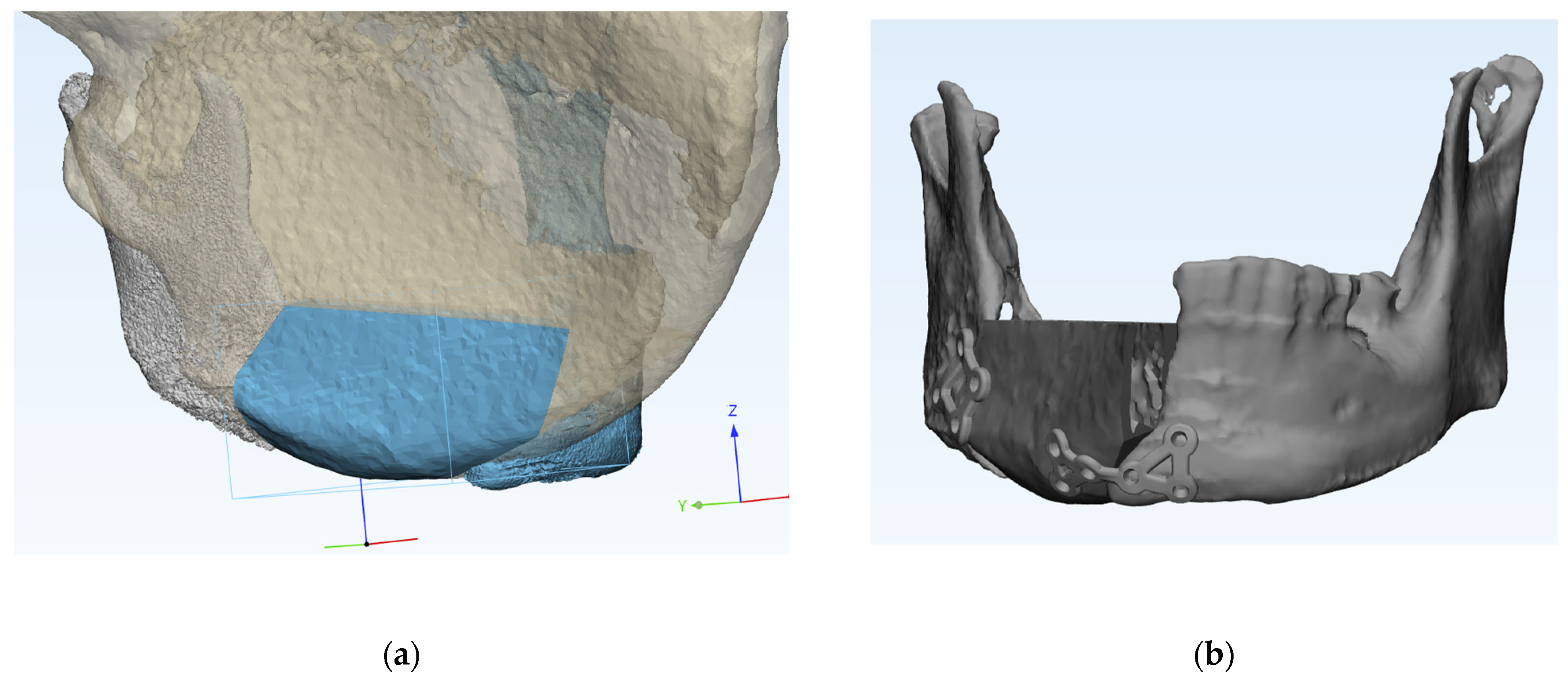 Applsci 15 01010 g003