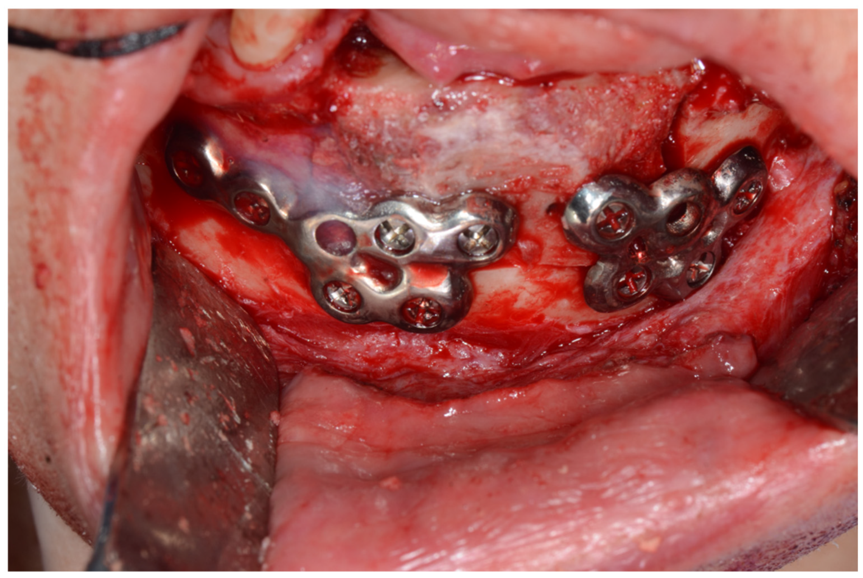 Applsci 15 01010 g008