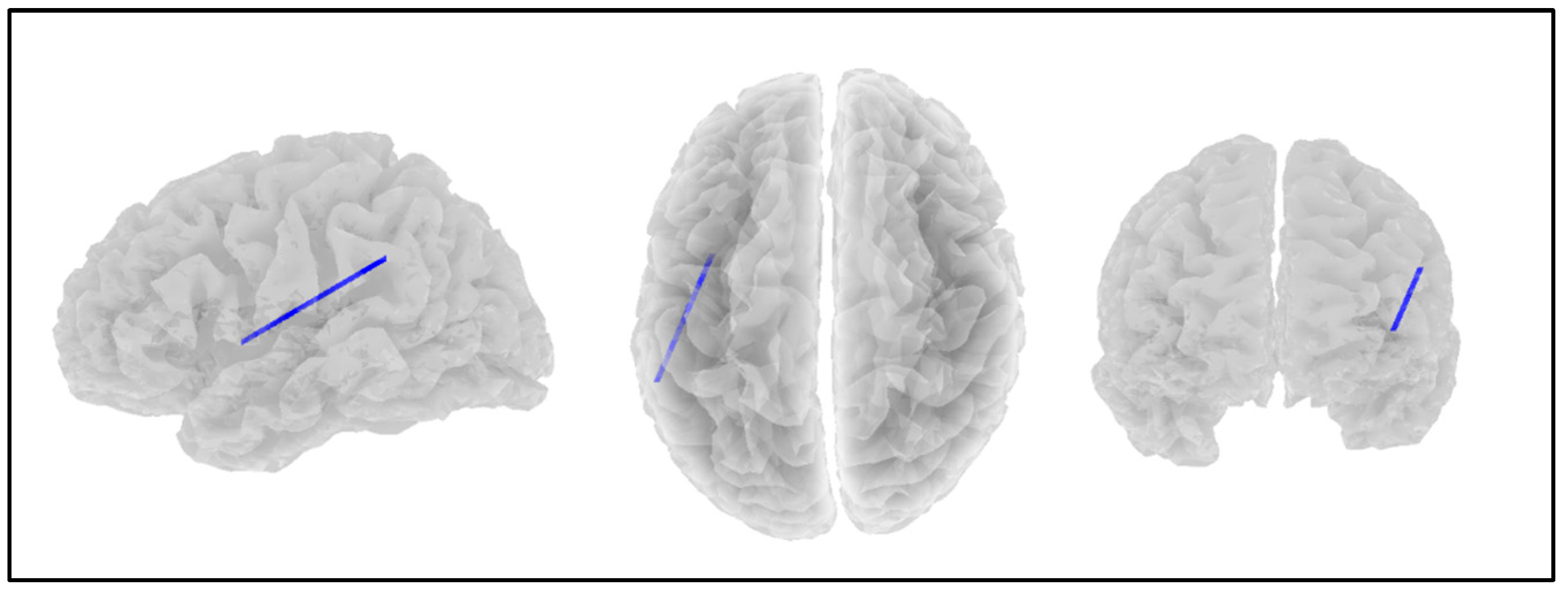 Applsci 15 01459 g003