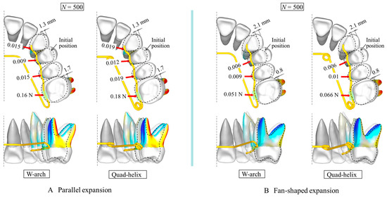 Mechanical Efficacy Equivalence of W-Arch and Quad-Helix Orthodontic ...