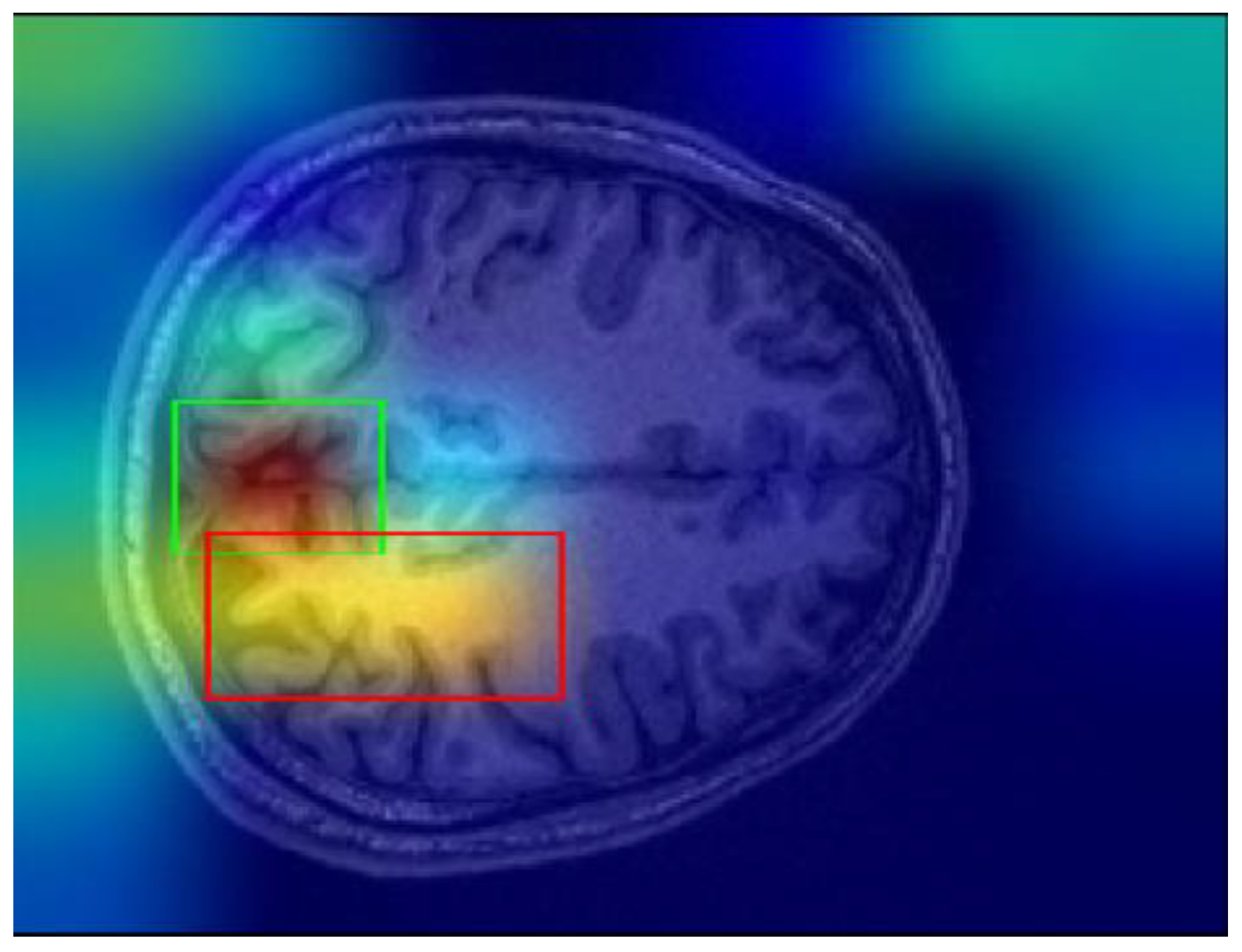 Applsci 15 01717 g011