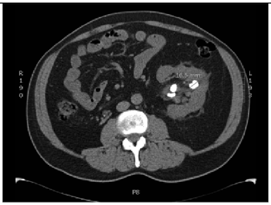 Applsci 15 01796 i003