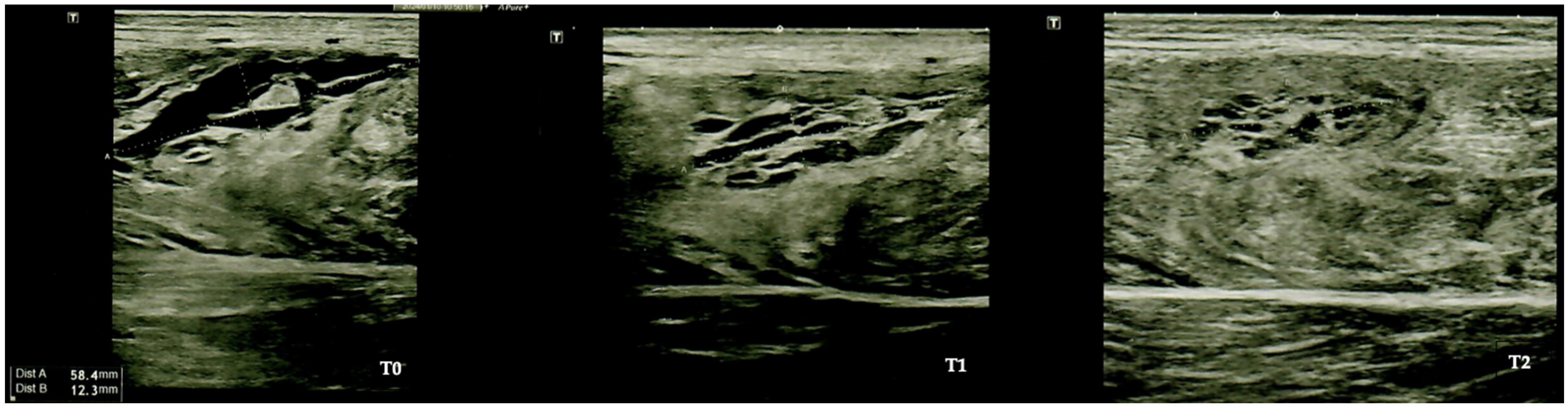 Applsci 15 02022 g002