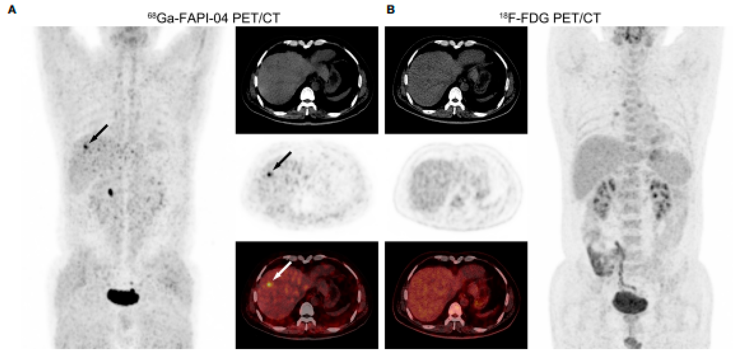 Applsci 15 02025 g002