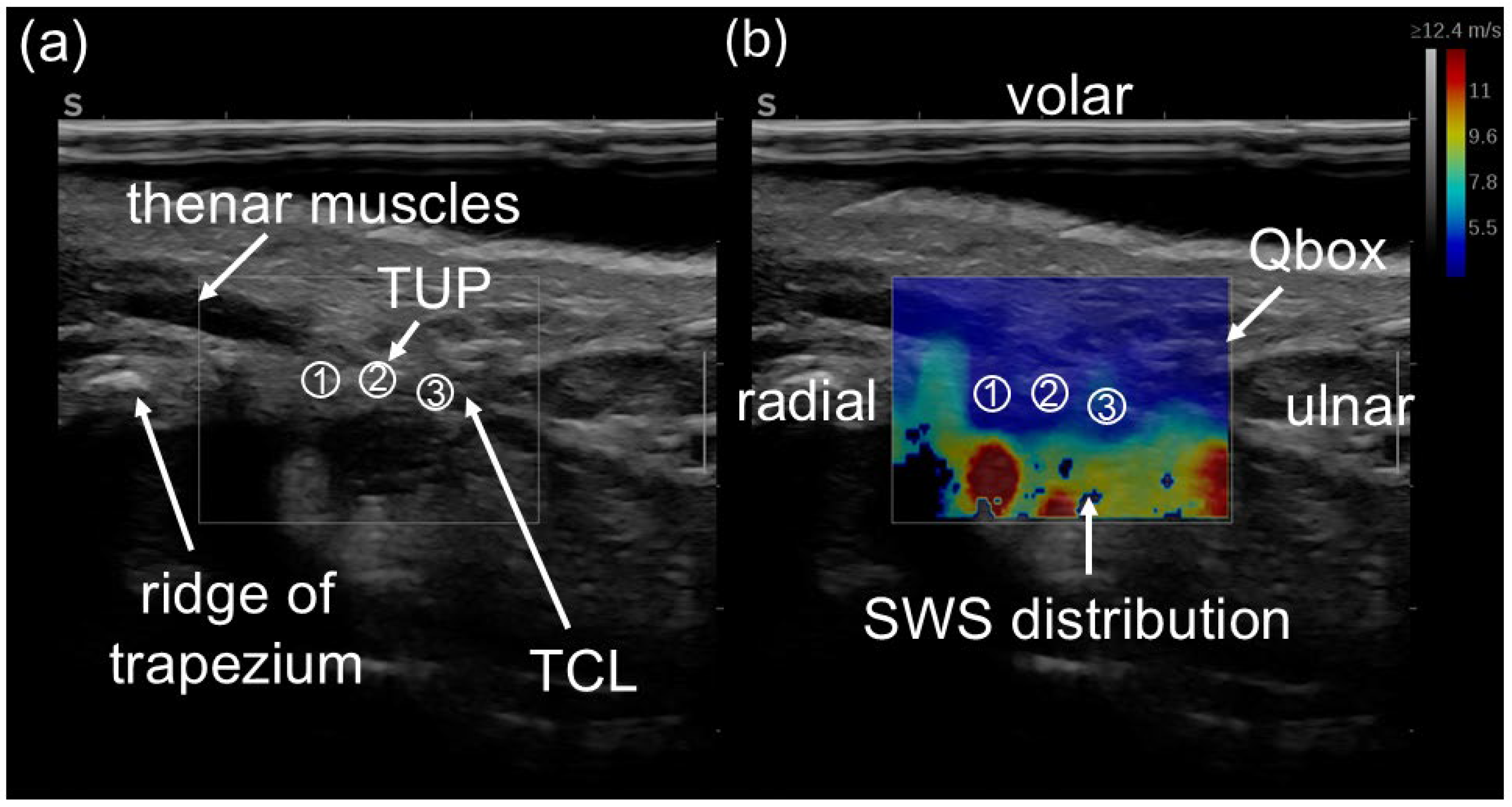 Applsci 15 02302 g003