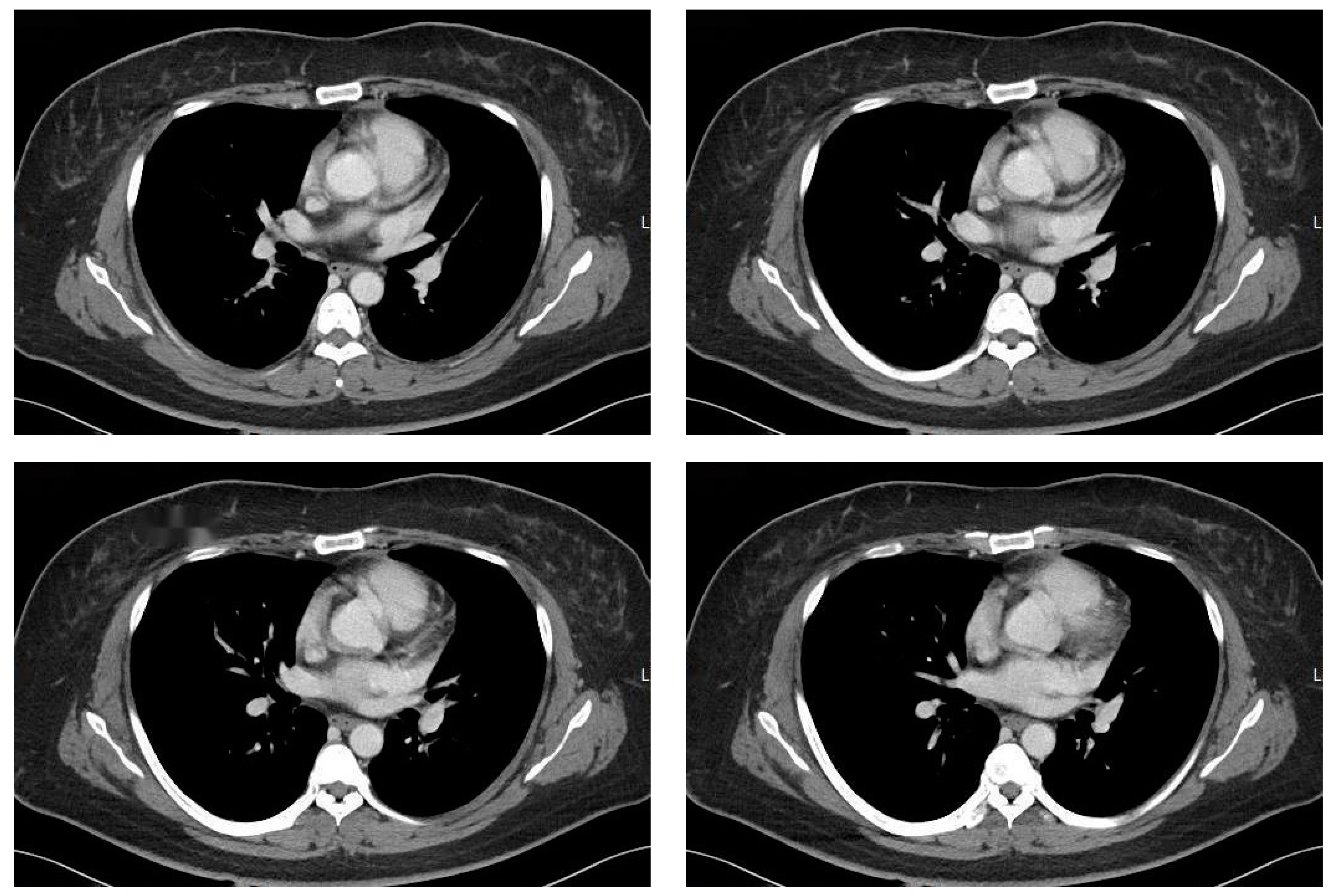 Applsci 15 02457 g005