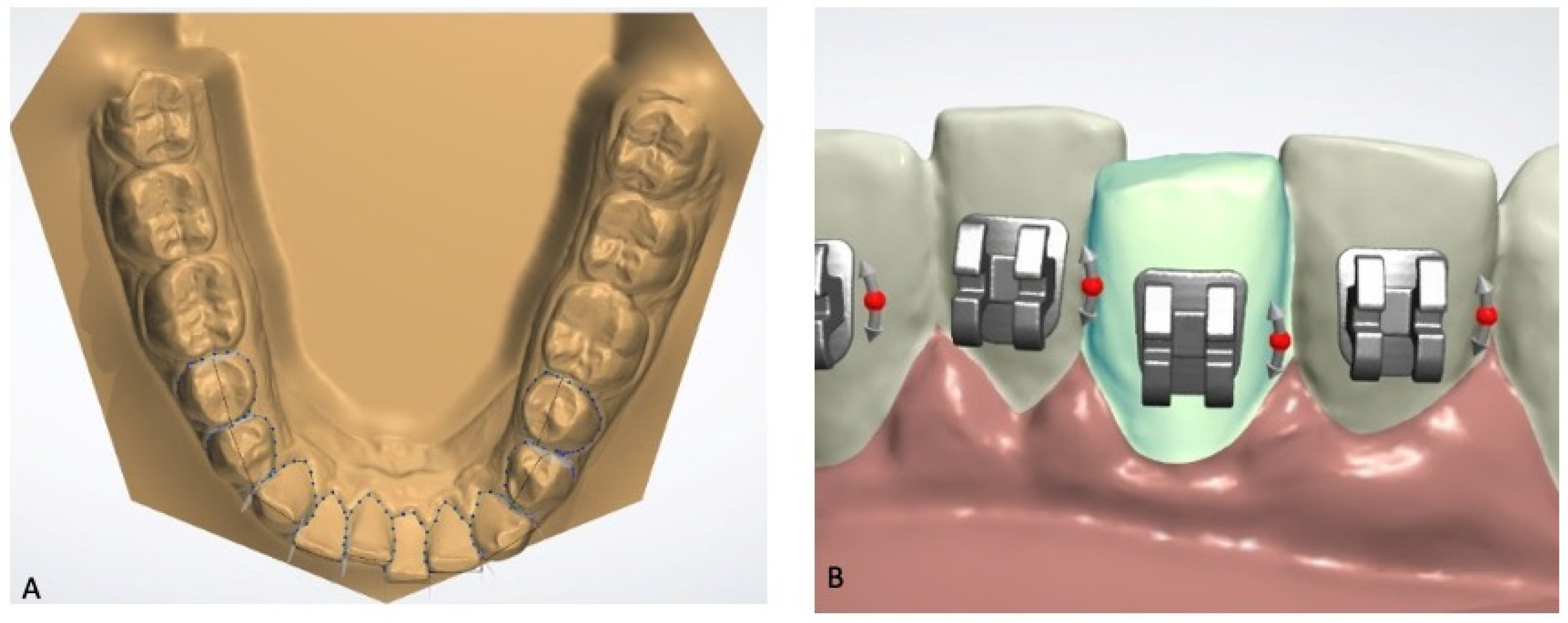 Applsci 15 02552 g004