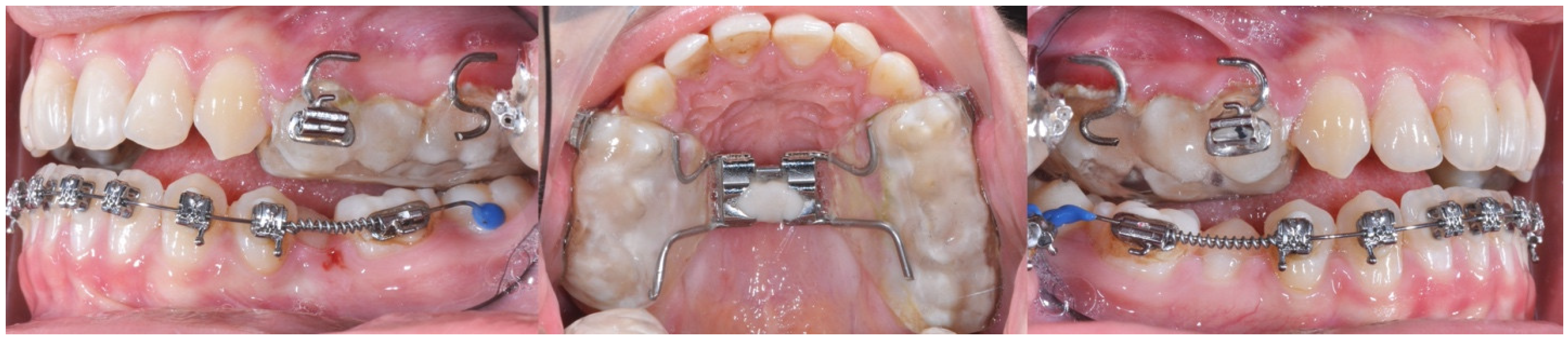 Applsci 15 02622 g001