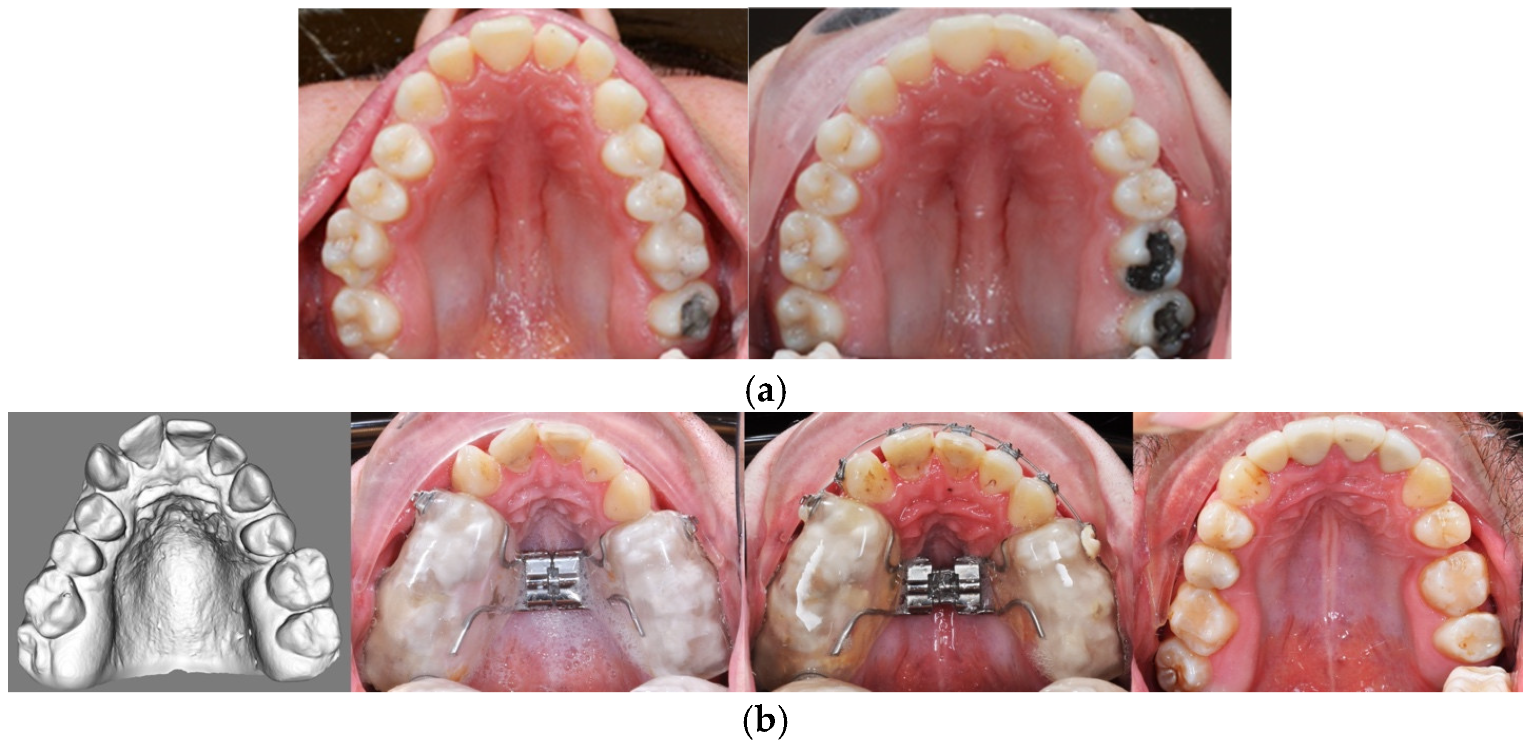 Applsci 15 02622 g010