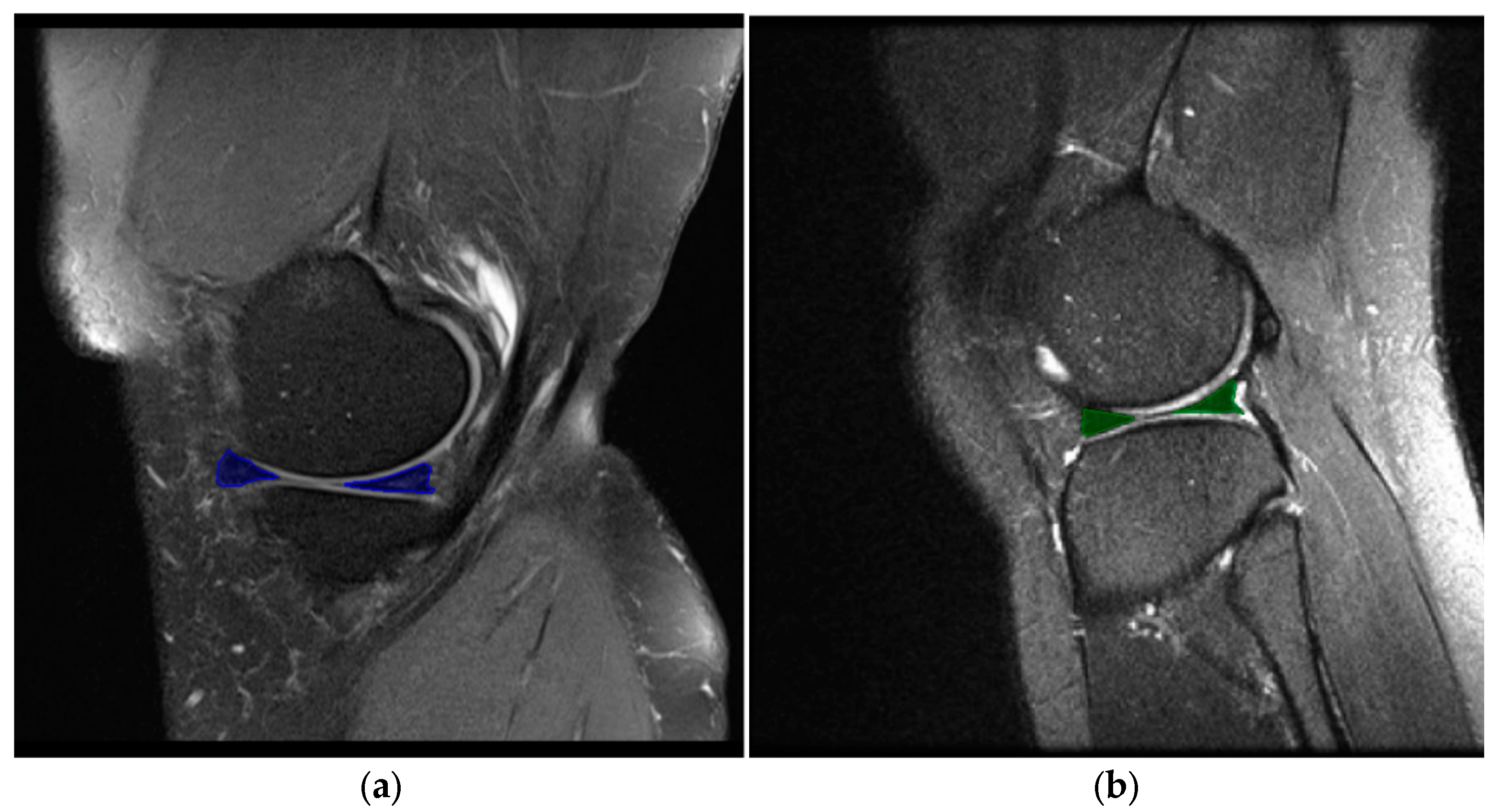 Applsci 15 02752 g003