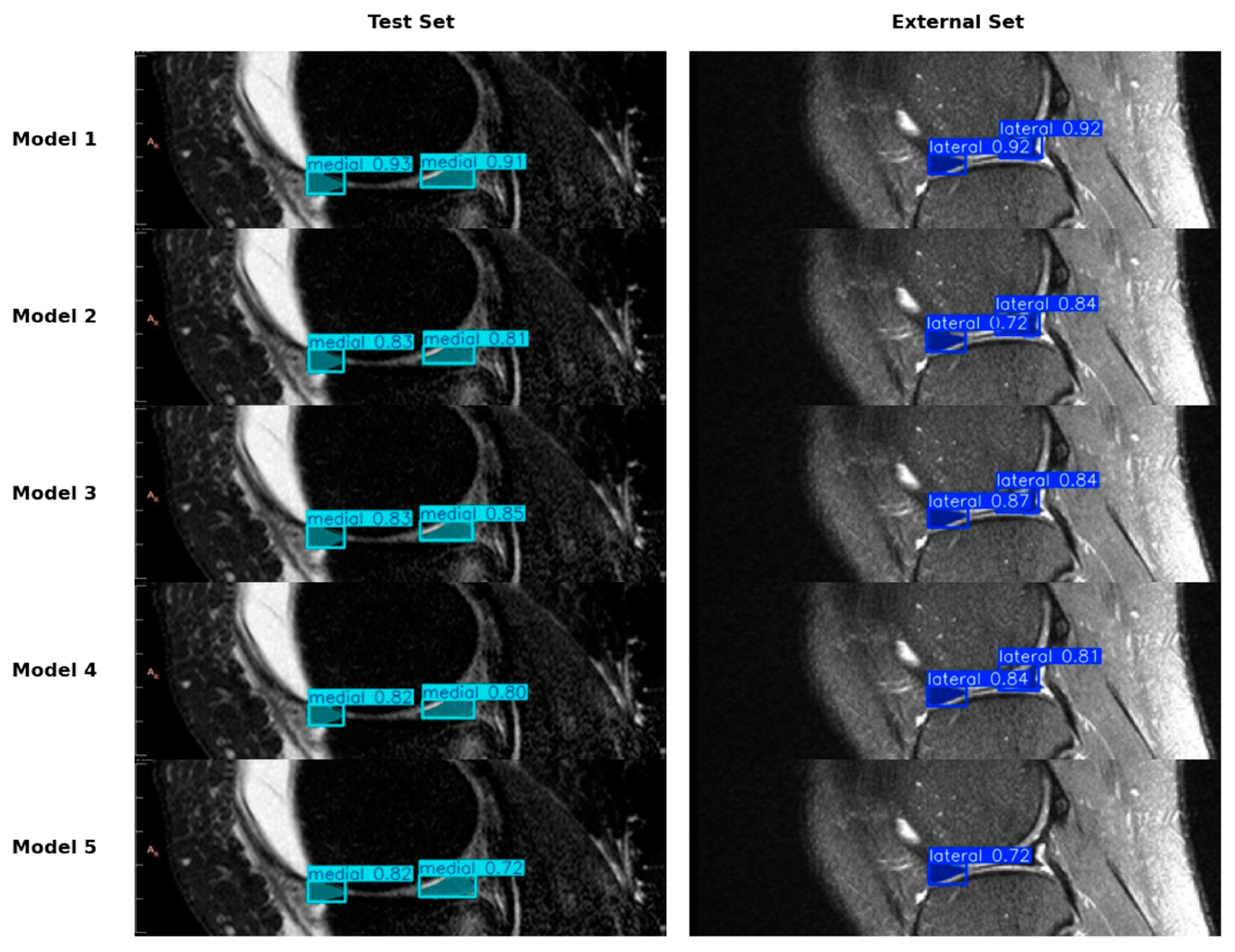 Applsci 15 02752 g005