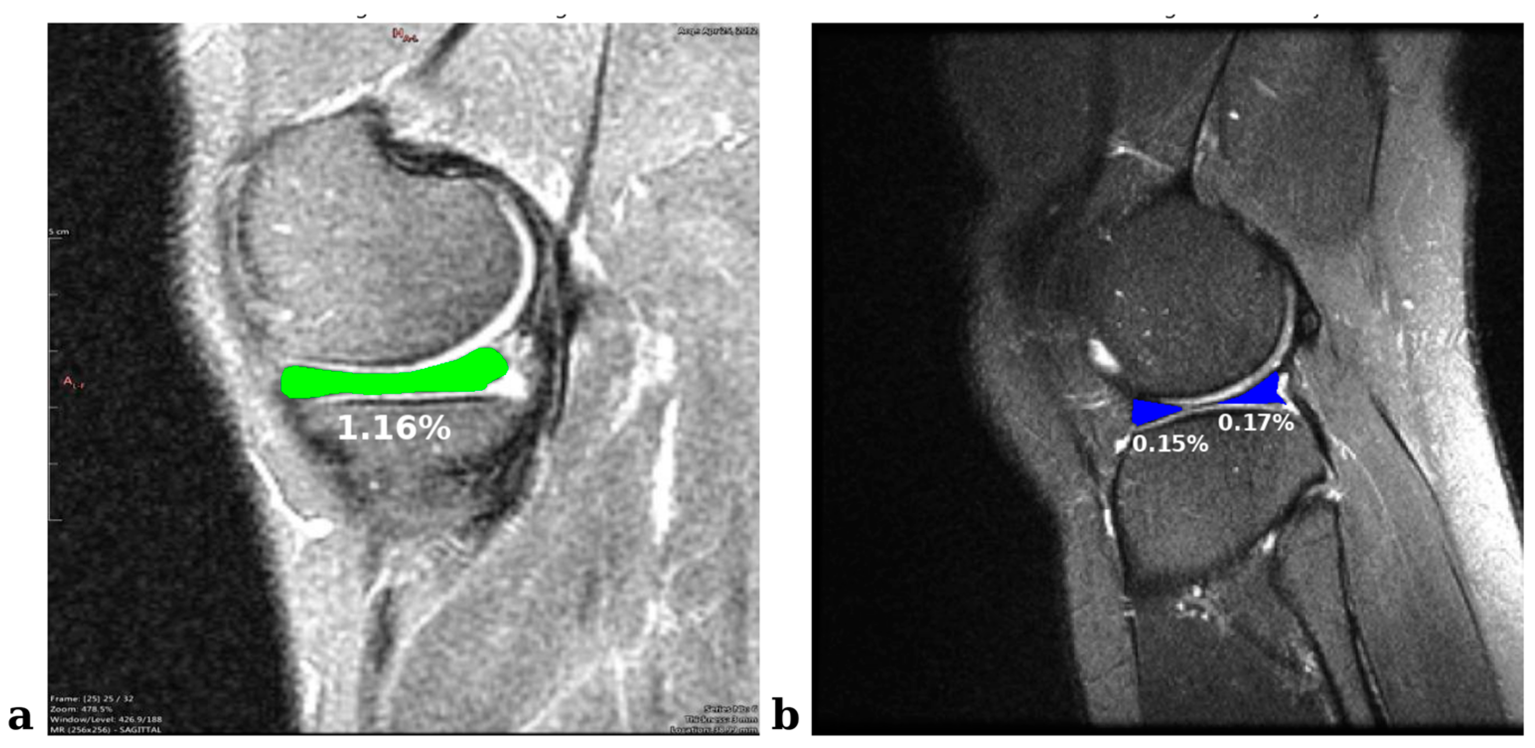 Applsci 15 02752 g007