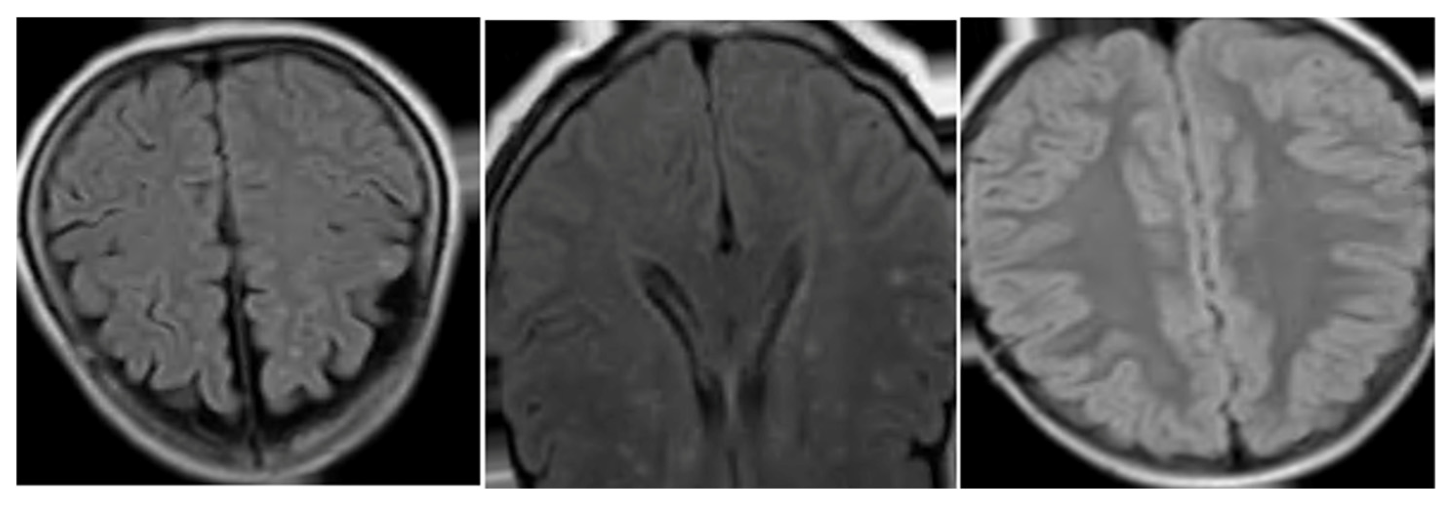 Applsci 15 02830 g005