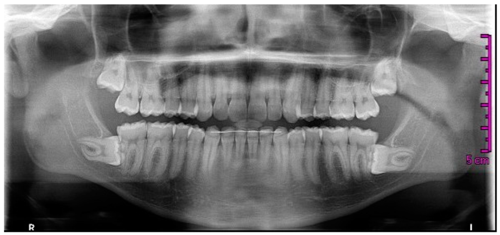 Applsci 15 02834 g001