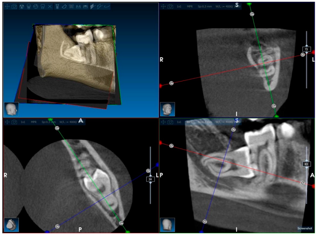 Applsci 15 02834 g002