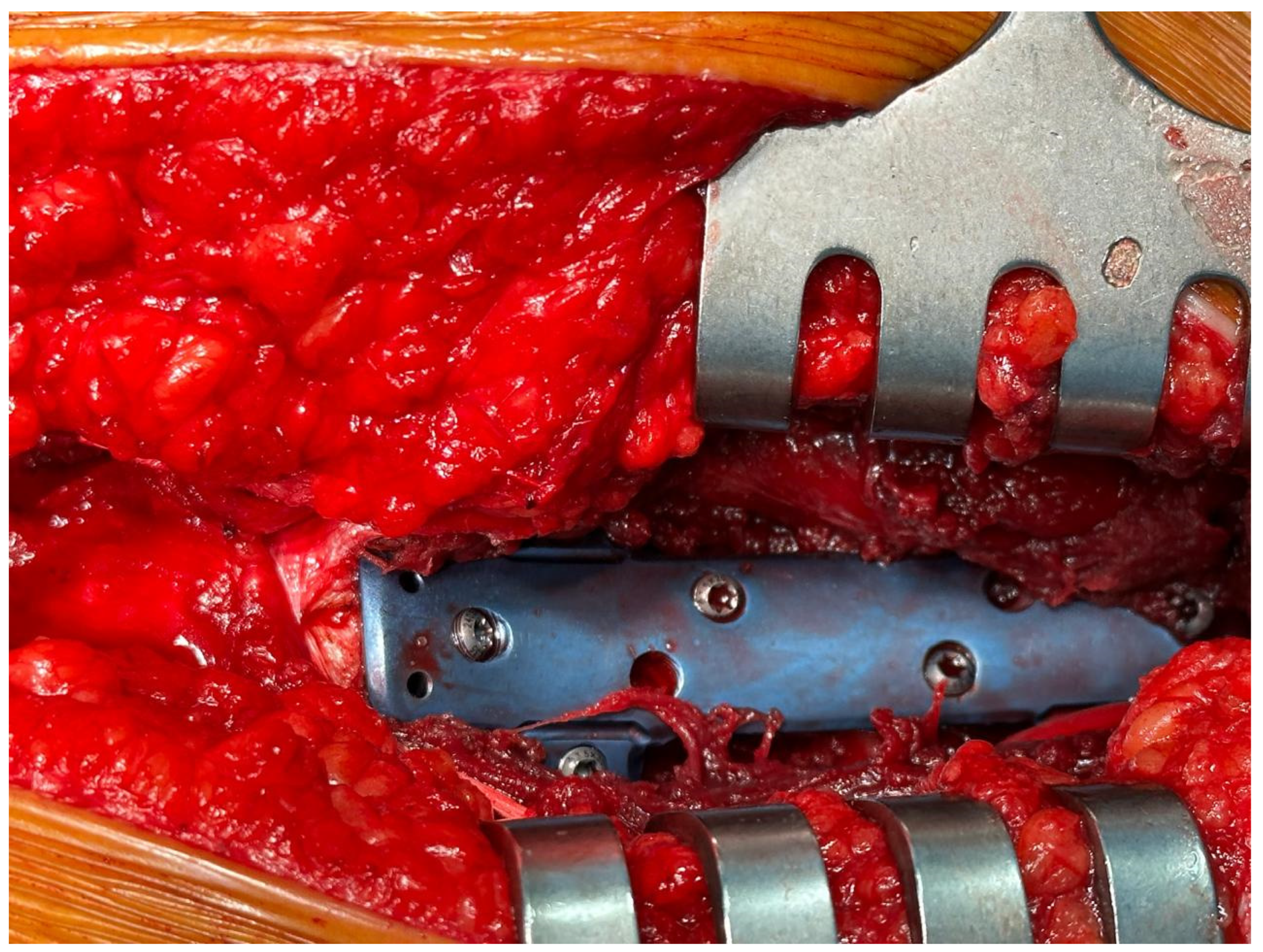 Applsci 15 02991 g0a2