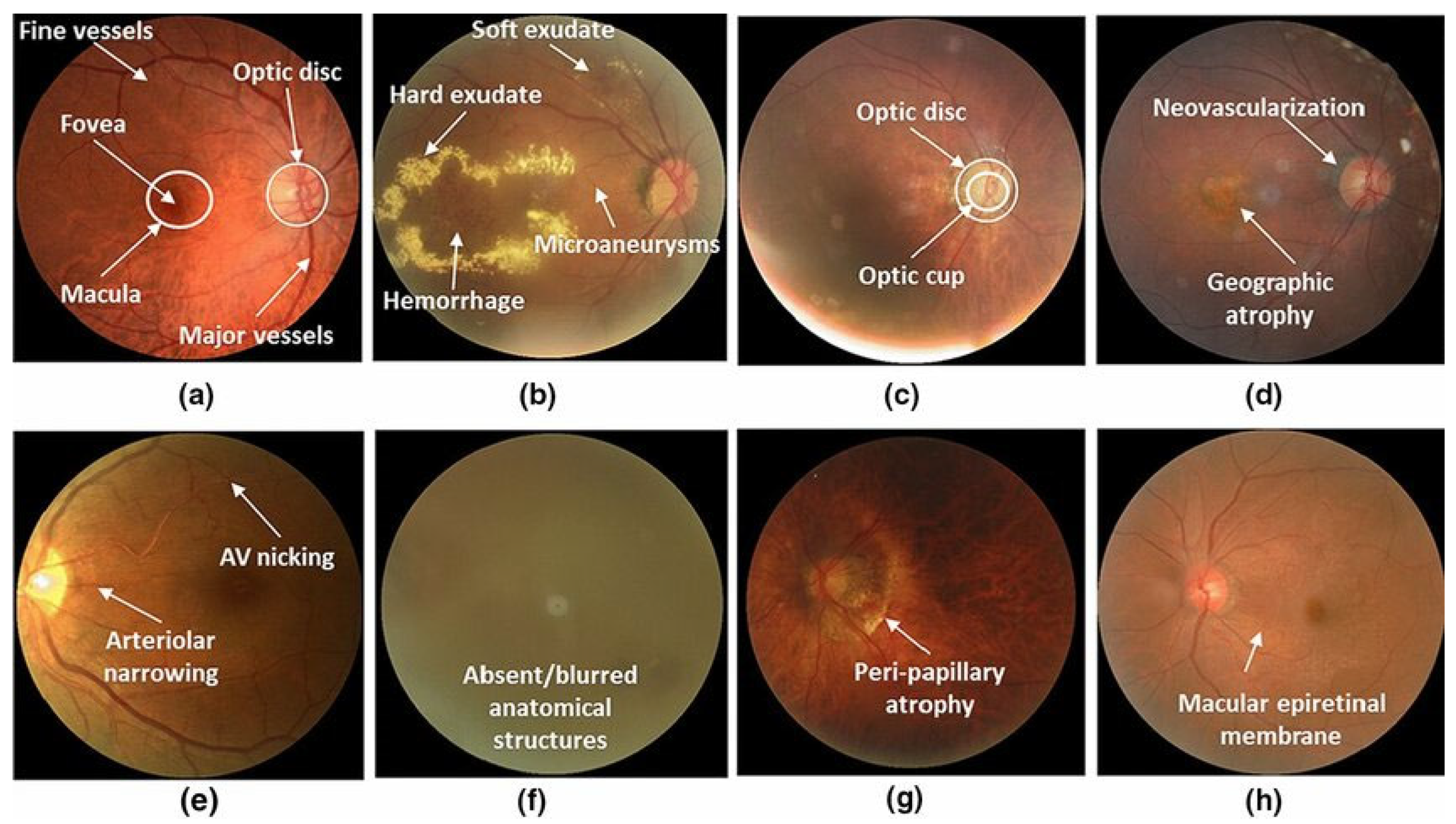 Applsci 15 03004 g002