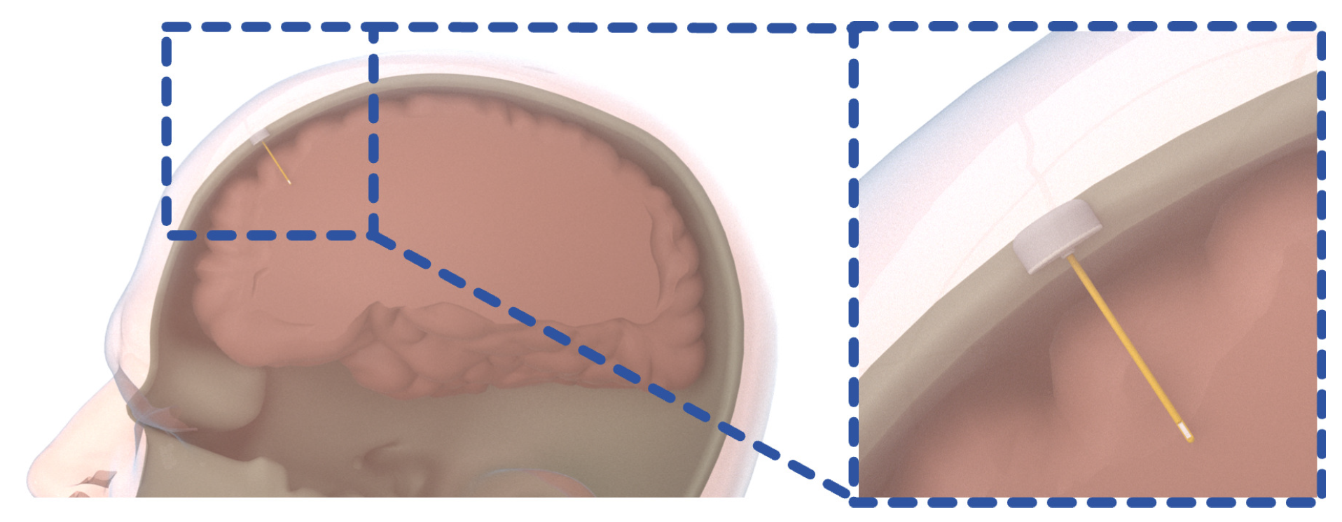 Applsci 15 03008 g001