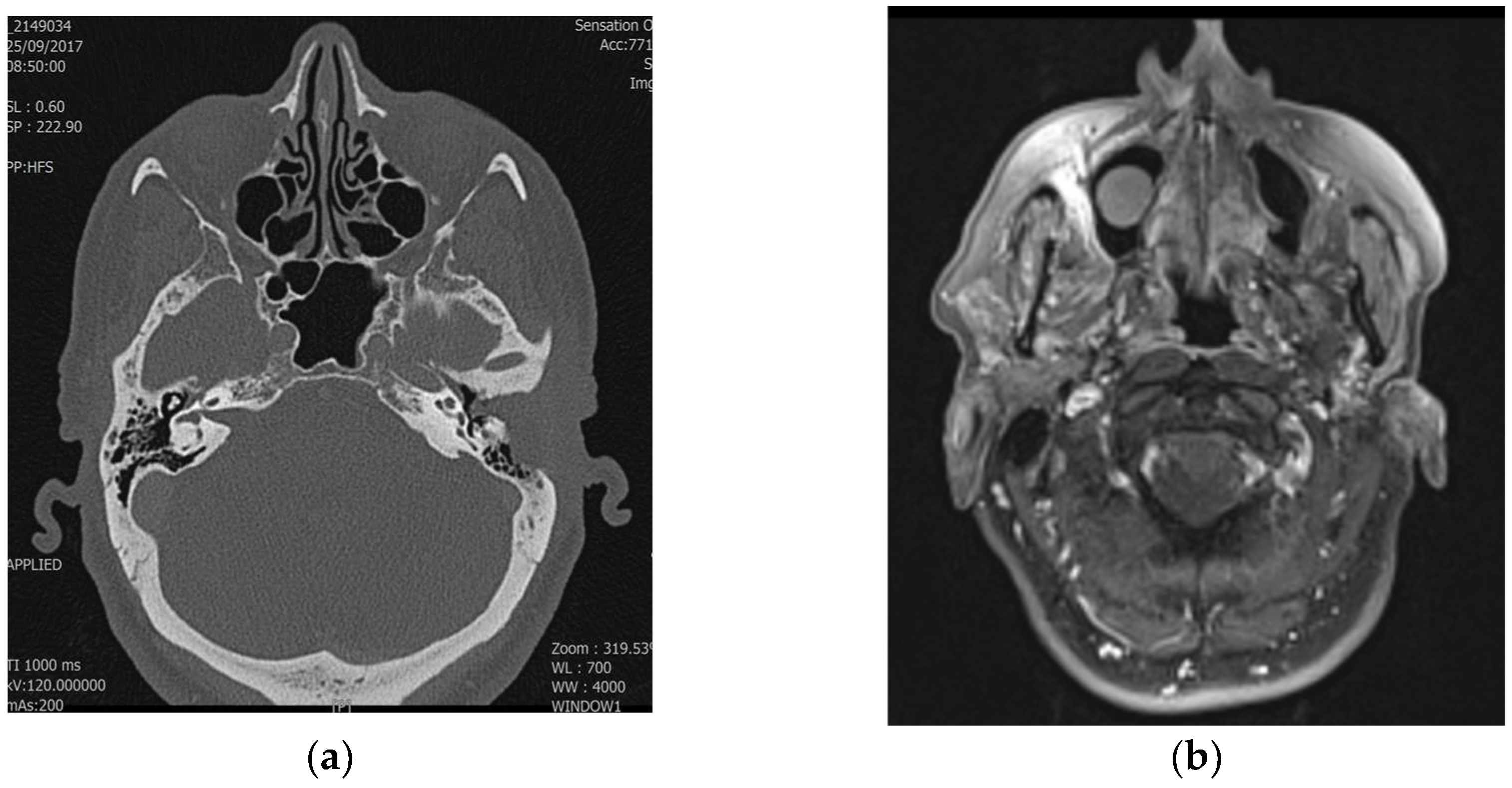 Applsci 15 03009 g002