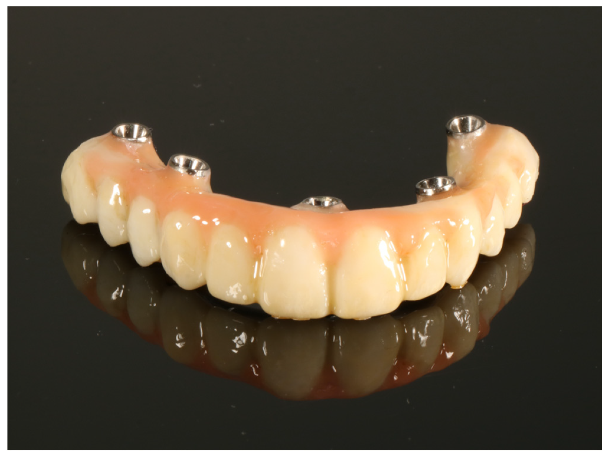 Applsci 15 03212 g003