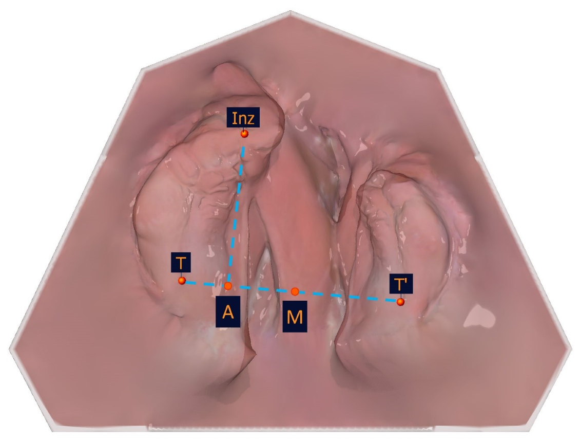 Applsci 15 03278 g006
