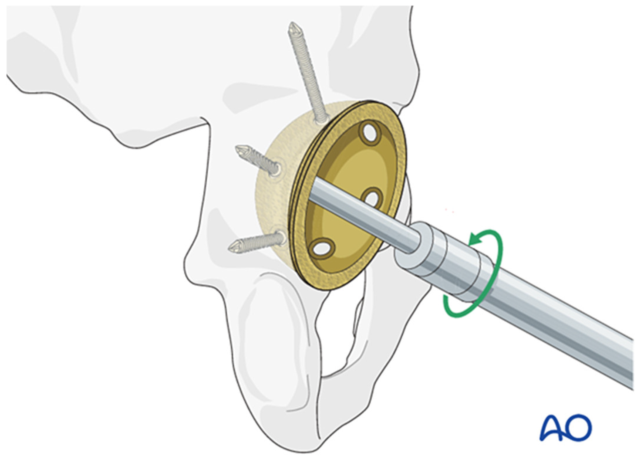 Applsci 15 03722 g002