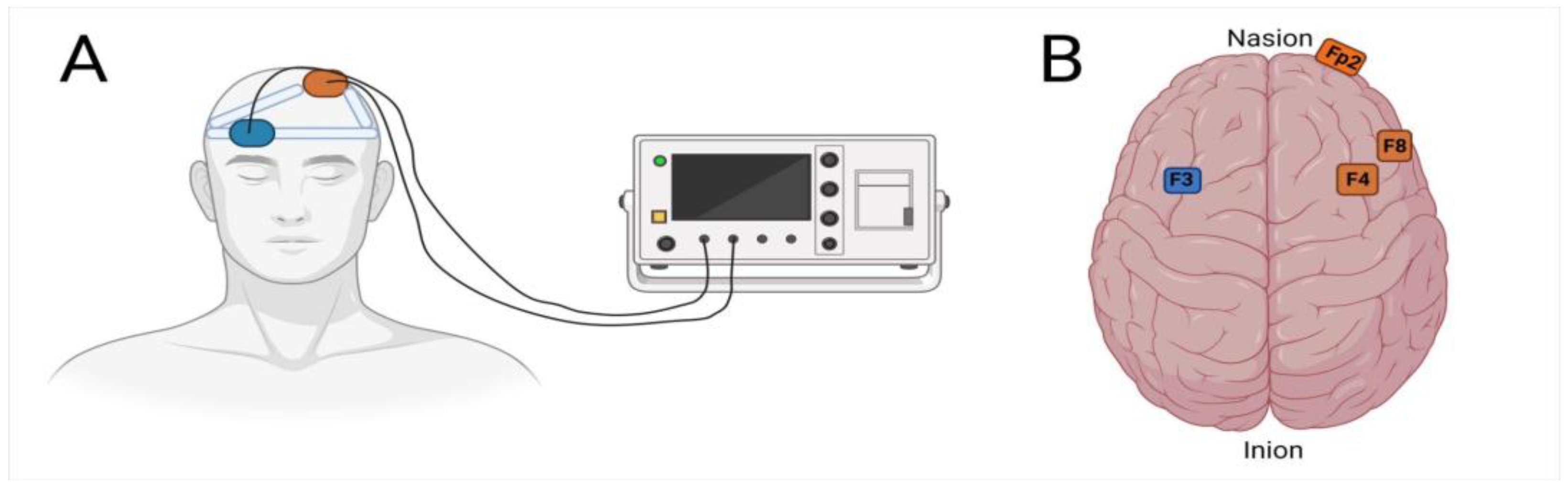 Applsci 15 04020 g001