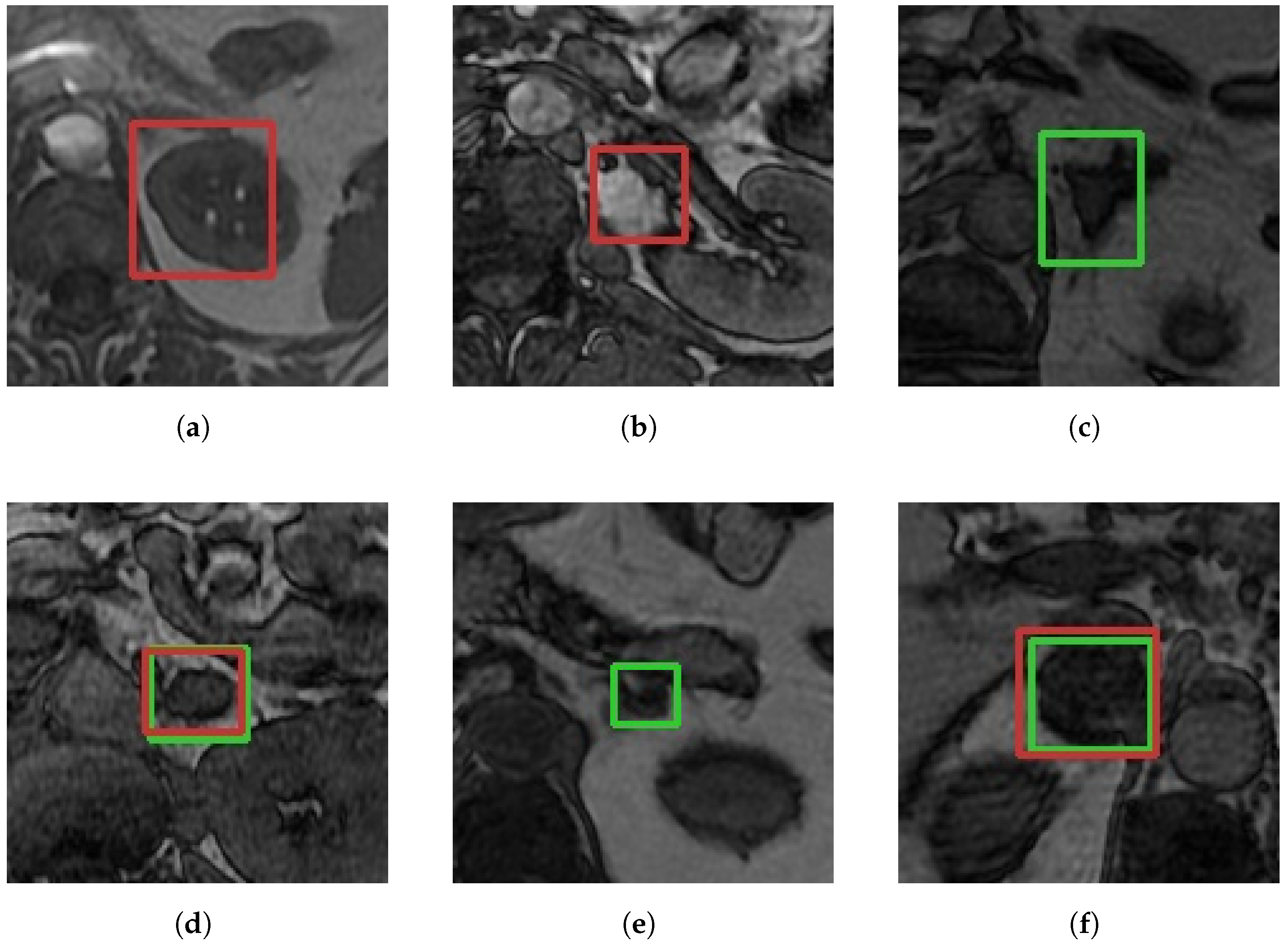 Applsci 15 04100 g004