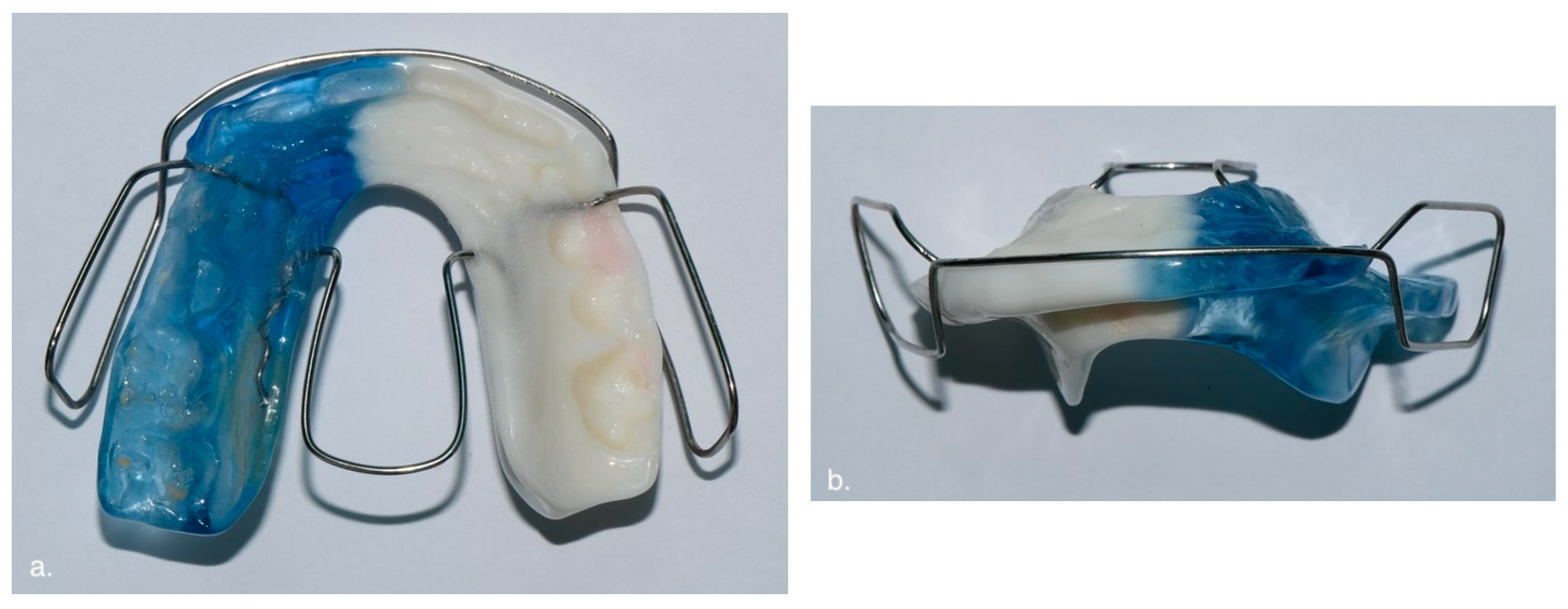 Applsci 15 04261 g002